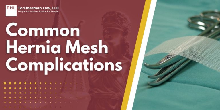 Common Hernia Mesh Complications; The Use of Surgical Mesh in Hernia Repair Surgery; The Use of Surgical Mesh in Hernia Repair Surgery; Impact of Hernia Mesh Complication; Treatment Options for Hernia Mesh Complications; Legal Implications of Hernia Mesh Complications; Seeking Legal Help