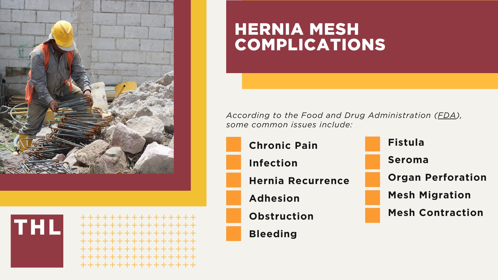 Understanding Hernia; Hernia Mesh Lawsuits; Hernia Mesh Complications