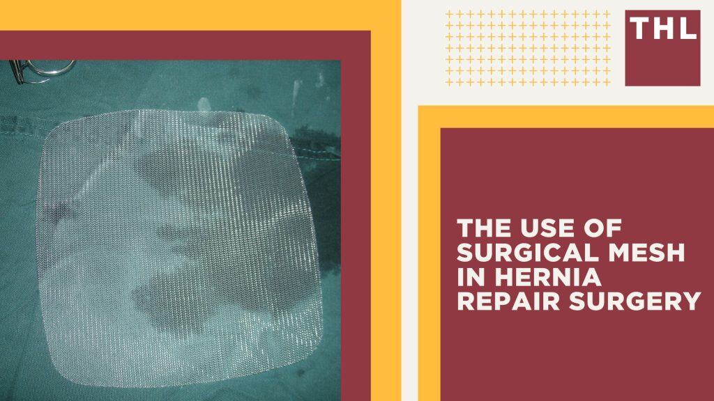 Common Hernia Mesh Complications [2026 Guide]
