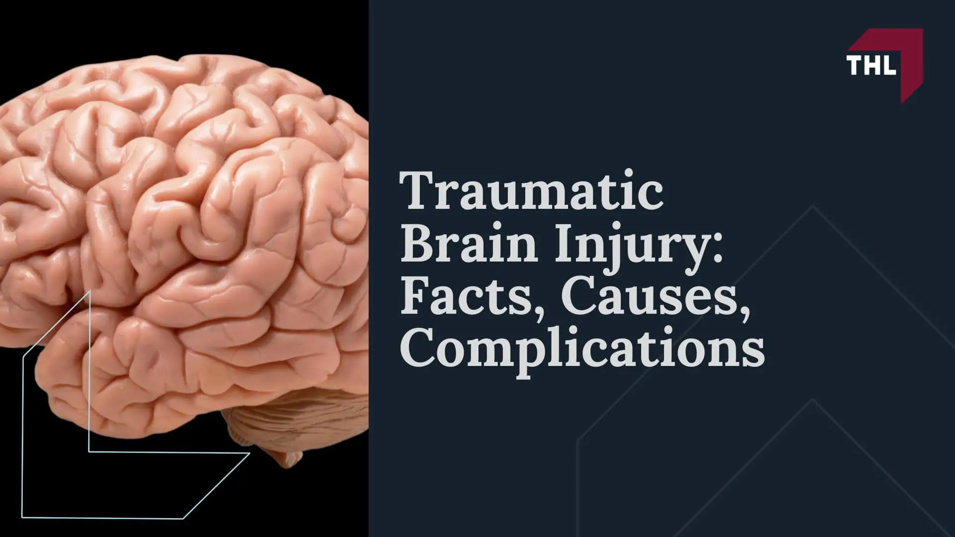 Traumatic Brain Injury_ Facts, Causes, Complications
