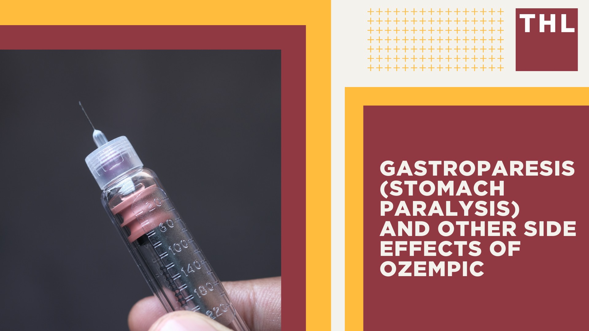 The Rising Popularity of GLP 1 Receptor Agonist Drugs; Gastroparesis (Stomach Paralysis) and Other Side Effects of Ozempic