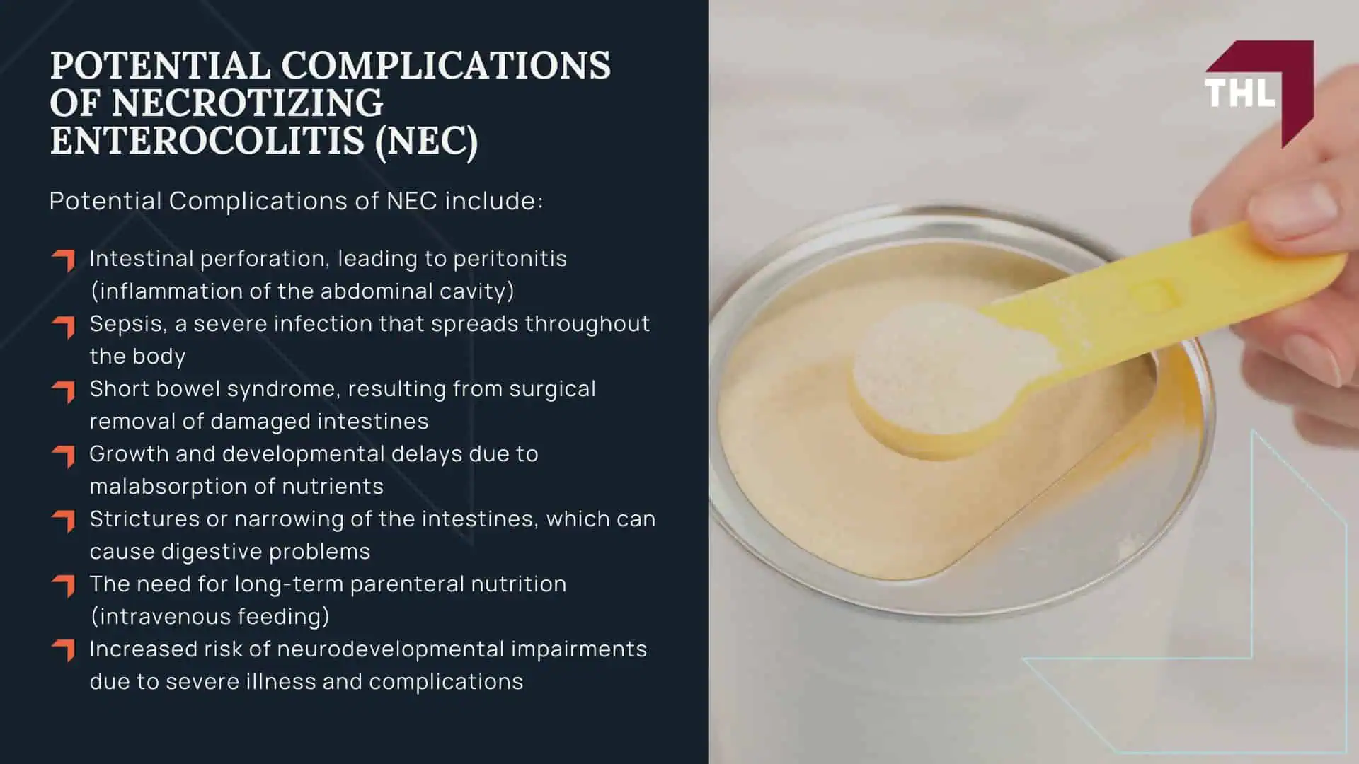 Qualifying Factors for NEC Baby Formula Lawsuits; An Overview of the NEC Baby Formula Lawsuit; Qualifying Factors for NEC Baby Formula Lawsuits; An Overview of the NEC Baby Formula Lawsuit; TorHoerman Law Obtains Landmark $495 Million Verdict Against Abbott Laboratories in NEC Baby Formula Trial; Necrotizing Enterocolitis (NEC) Explained; Signs and Symptoms of Necrotizing Enterocolitis (NEC); Potential Complications of Necrotizing Enterocolitis (NEC)