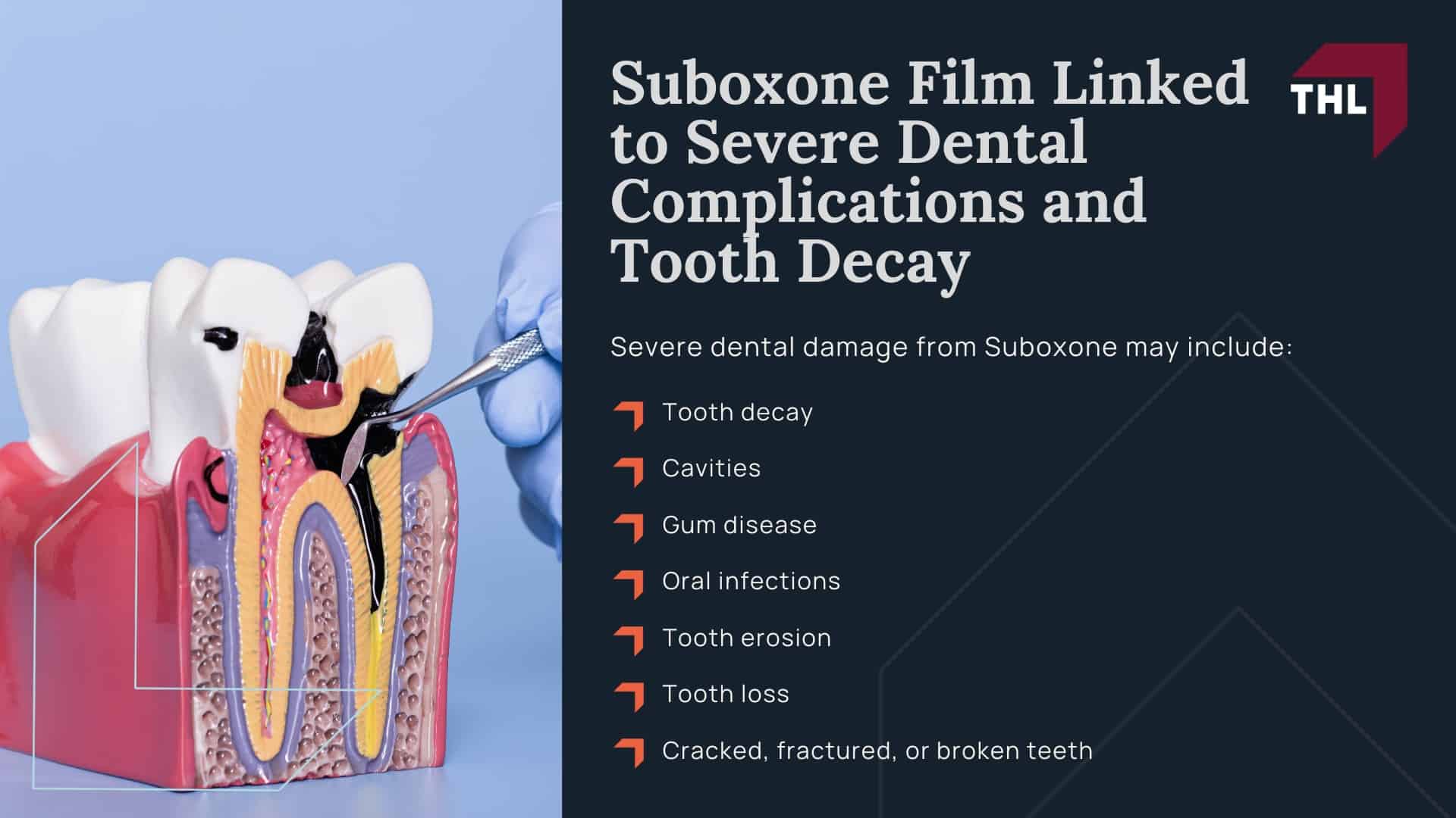 Suboxone Lawsuit Payout Per Person - What is the Average Payout in the Suboxone Tooth Decay Lawsuit - torhoerman law; Suboxone Lawsuit Payout Per Person - How is Compensation in the Suboxone Tooth Decay Lawsuit Determined - torhoerman law; Suboxone Lawsuit Payout Per Person - Suboxone Film Linked to Severe Dental Complications and Tooth Decay - torhoerman law