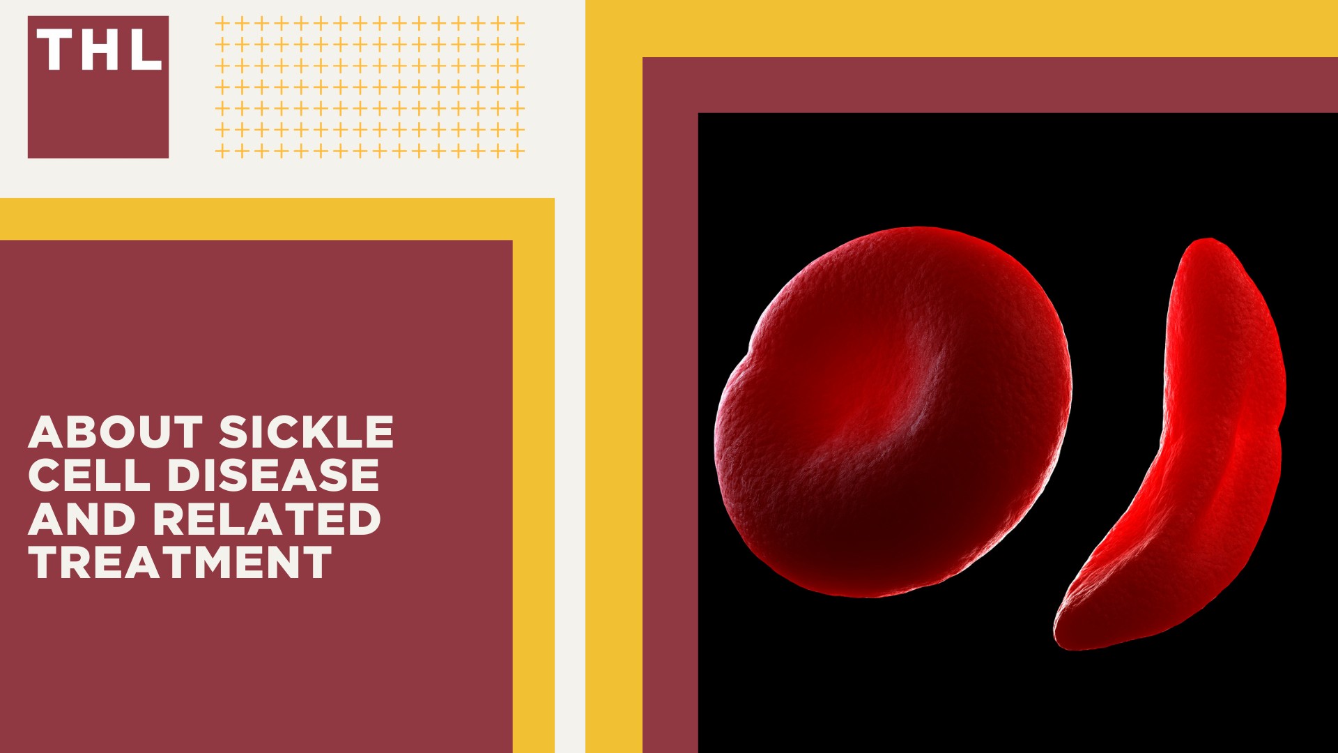 Oxbryta Lawsuit Investigation Overview; Injuries and Health Complications Potentially Linked to Oxbryta Use; What is Oxbryta; About Sickle Cell Disease and Related Treatment