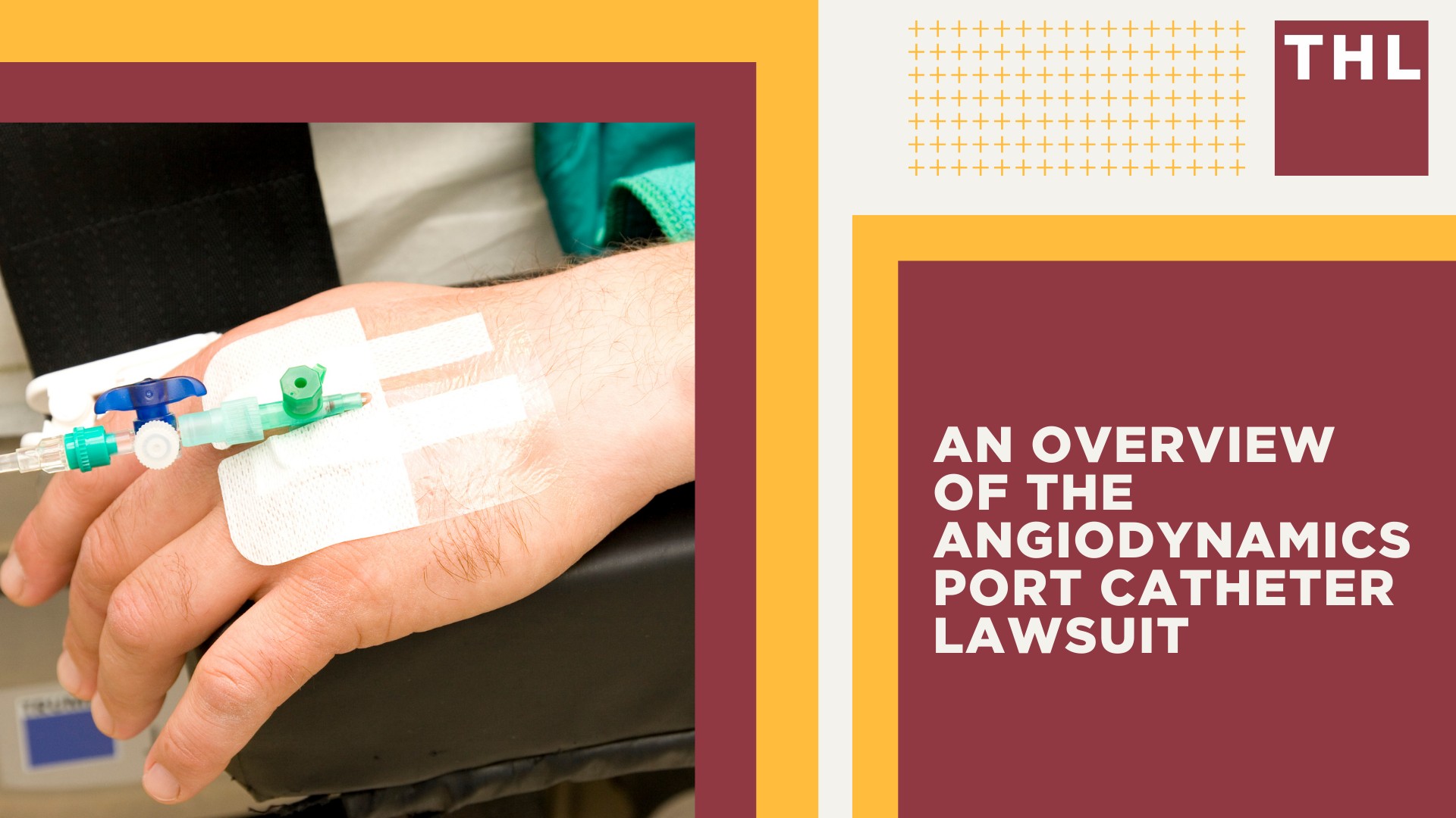 An Overview of the AngioDynamics Port Catheter Lawsuit