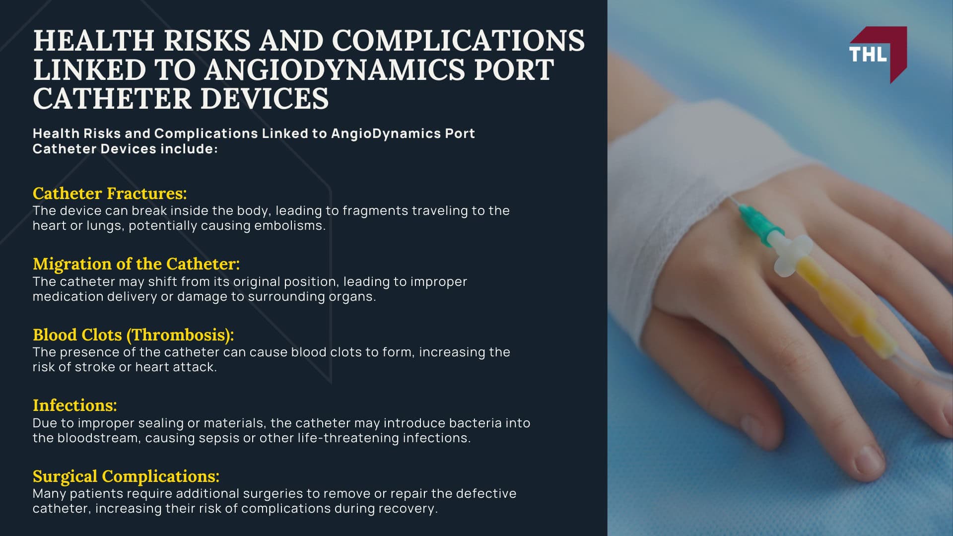 AngioDynamics Port Catheter Lawsuit - An Overview of the AngioDynamics Port Catheter Lawsuit - - torhoerman law; AngioDynamics Port Catheter Lawsuit - What is the AngioDynamics Port Catheter MDL_ - torhoerman law; AngioDynamics Port Catheter Lawsuit - What AngioDynamics Inc Devices May Be Defective and Dangerous_ - torhoerman law; AngioDynamics Port Catheter Lawsuit - Health Risks and Complications Linked to AngioDynamics Port Catheter Devices - torhoerman law