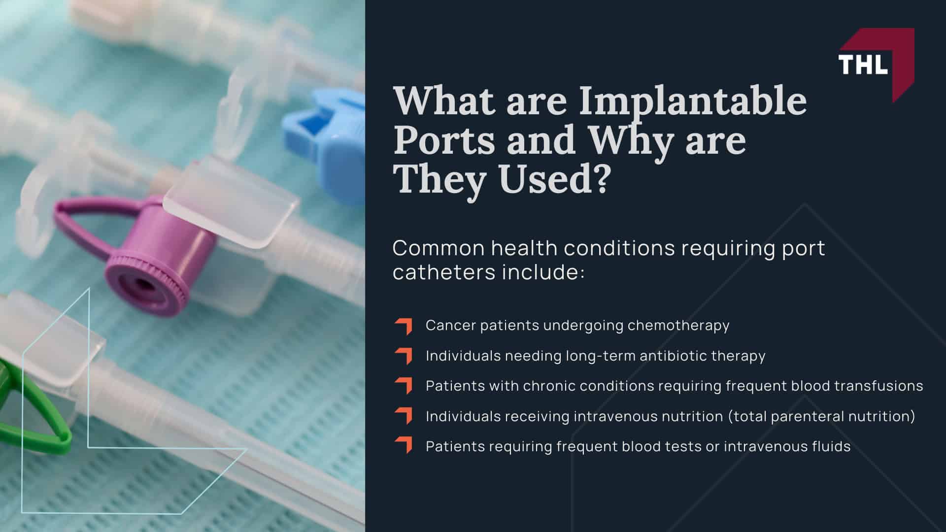AngioDynamics Port Catheter Lawsuit - An Overview of the AngioDynamics Port Catheter Lawsuit - torhoerman law; AngioDynamics Port Catheter Lawsuit - What is the AngioDynamics Port Catheter MDL - torhoerman law; AngioDynamics Port Catheter Lawsuit - What AngioDynamics Inc Devices May Be Defective and Dangerous - torhoerman law; AngioDynamics Port Catheter Lawsuit - Health Risks and Complications Linked to AngioDynamics Port Catheter Devices - torhoerman law; AngioDynamics Port Catheter Lawsuit - Long-Term Health Consequences of Port Catheter Defects - torhoerman law; AngioDynamics Port Catheter Lawsuit - What are Implantable Ports and Why are They Used - torhoerman law