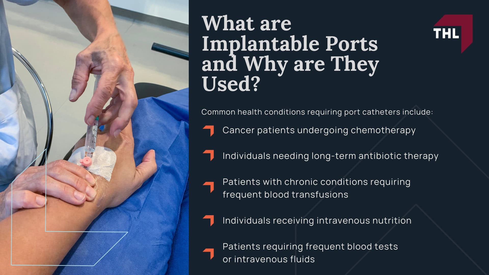 AngioDynamics Port Catheter Lawsuit - An Overview of the AngioDynamics Port Catheter Lawsuit - - torhoerman law; AngioDynamics Port Catheter Lawsuit - What is the AngioDynamics Port Catheter MDL_ - torhoerman law; AngioDynamics Port Catheter Lawsuit - What AngioDynamics Inc Devices May Be Defective and Dangerous_ - torhoerman law; AngioDynamics Port Catheter Lawsuit - Health Risks and Complications Linked to AngioDynamics Port Catheter Devices - torhoerman law; AngioDynamics Port Catheter Lawsuit - Long-Term Health Consequences of Port Catheter Defects - torhoerman law; AngioDynamics Port Catheter Lawsuit - What are Implantable Ports and Why are They Used_ - torhoerman law