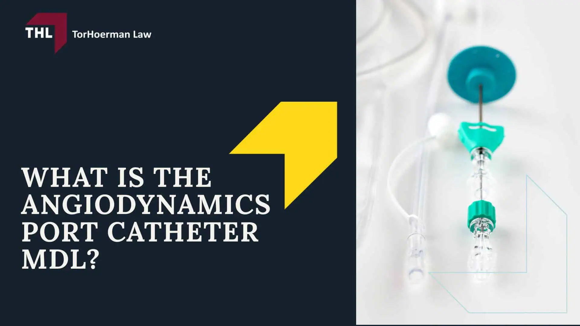 AngioDynamics Port Catheter Lawsuit - An Overview of the AngioDynamics Port Catheter Lawsuit - - torhoerman law; AngioDynamics Port Catheter Lawsuit - What is the AngioDynamics Port Catheter MDL_ - torhoerman law