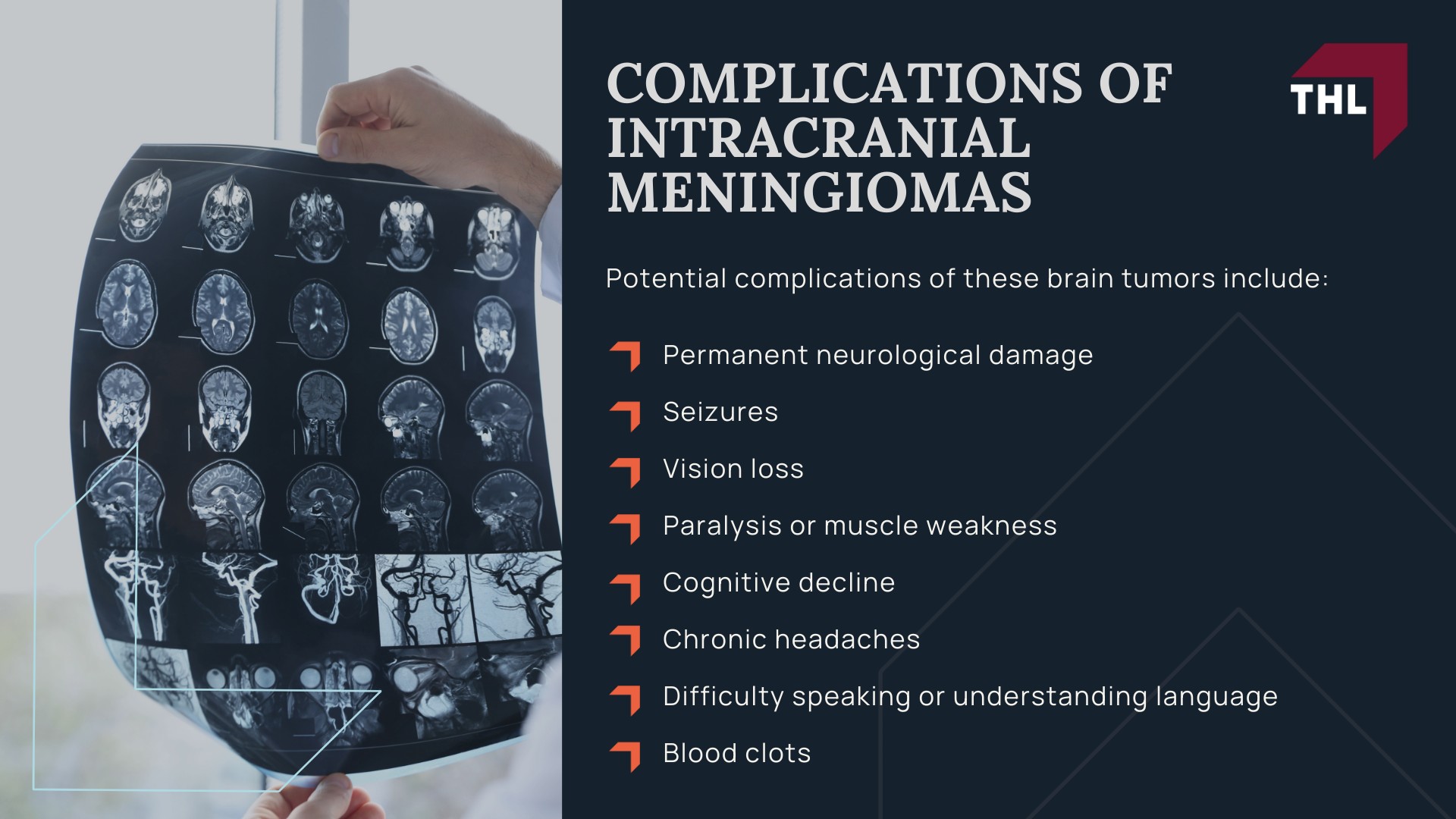 ESTIMATED DEPO-PROVERA LAWSUIT SETTLEMENT AMOUNTS - DEPO-PROVERA LAWSUIT SETTLEMENT AMOUNT - DEPO-PROVERA LAWSUIT - TORHOERMAN LAW; ESTIMATED DEPO-PROVERA LAWSUIT SETTLEMENT AMOUNTS - DEPO-PROVERA LAWSUIT SETTLEMENT AMOUNT - DEPO-PROVERA LAWSUIT - TORHOERMAN LAW (1); HOW MIGHT DEPO PROVERA SETTLEMENT AMOUNTS BE DETERMINED - DEPO-PROVERA LAWSUIT SETTLEMENT AMOUNT - DEPO-PROVERA LAWSUIT - TORHOERMAN LAW; DEPO-PROVERA LITIGATION OVERVIEW - DEPO-PROVERA LAWSUIT SETTLEMENT AMOUNT - DEPO-PROVERA LAWSUIT - TORHOERMAN LAW; Scientific Study Links the Use of Depo-Provera to Brain Tumors; SYMPTOMS OF INTRACRANIAL MENINGIOMAS - DEPO-PROVERA LAWSUIT SETTLEMENT AMOUNT - DEPO-PROVERA LAWSUIT - TORHOERMAN LAW; COMPLICATIONS OF INTRACRANIAL MENINGIOMAS - DEPO-PROVERA LAWSUIT SETTLEMENT AMOUNT - DEPO-PROVERA LAWSUIT - TORHOERMAN LAW
