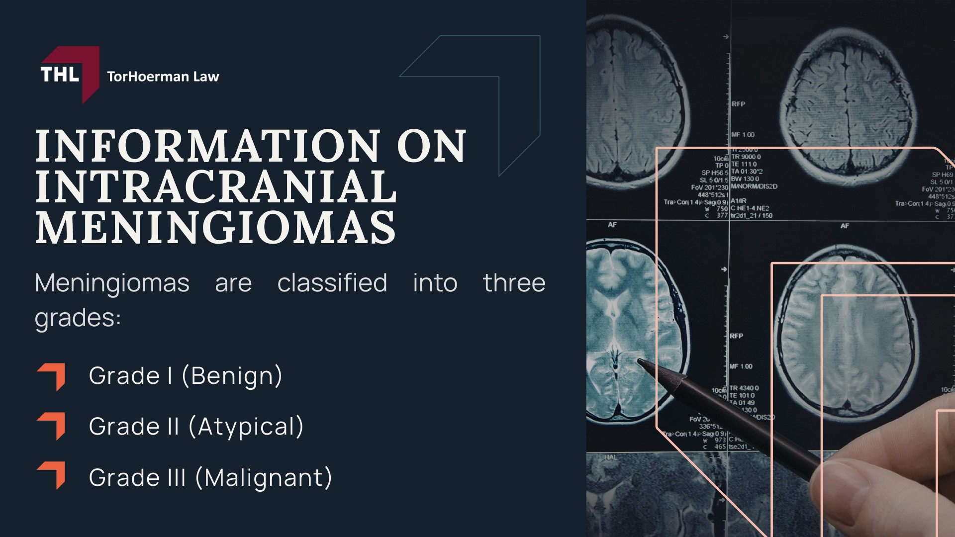 DEPO-PROVERA BRAIN TUMOR LAWSUIT - DEPO-PROVERA LAWSUIT - TORHOERMAN LAW; Claims Filed by Depo-Provera Patients Over Increased Risk of Brain Tumors; SCIENTIFIC STUDIES DEPO-PROVERA USERS AT RISK OF BRAIN TUMORS - DEPO-PROVERA BRAIN TUMOR LAWSUIT - DEPO-PROVERA LAWSUIT - TORHOERMAN LAW; DOES THE DEPO-PROVERA WARNING LABEL INCLUDE BRAIN TUMOR RISK - DEPO-PROVERA BRAIN TUMOR LAWSUIT - DEPO-PROVERA LAWSUIT - TORHOERMAN LAW; INFORMATION ON INTRACRANIAL MENINGIOMAS - DEPO-PROVERA BRAIN TUMOR LAWSUIT - DEPO-PROVERA LAWSUIT - TORHOERMAN LAW