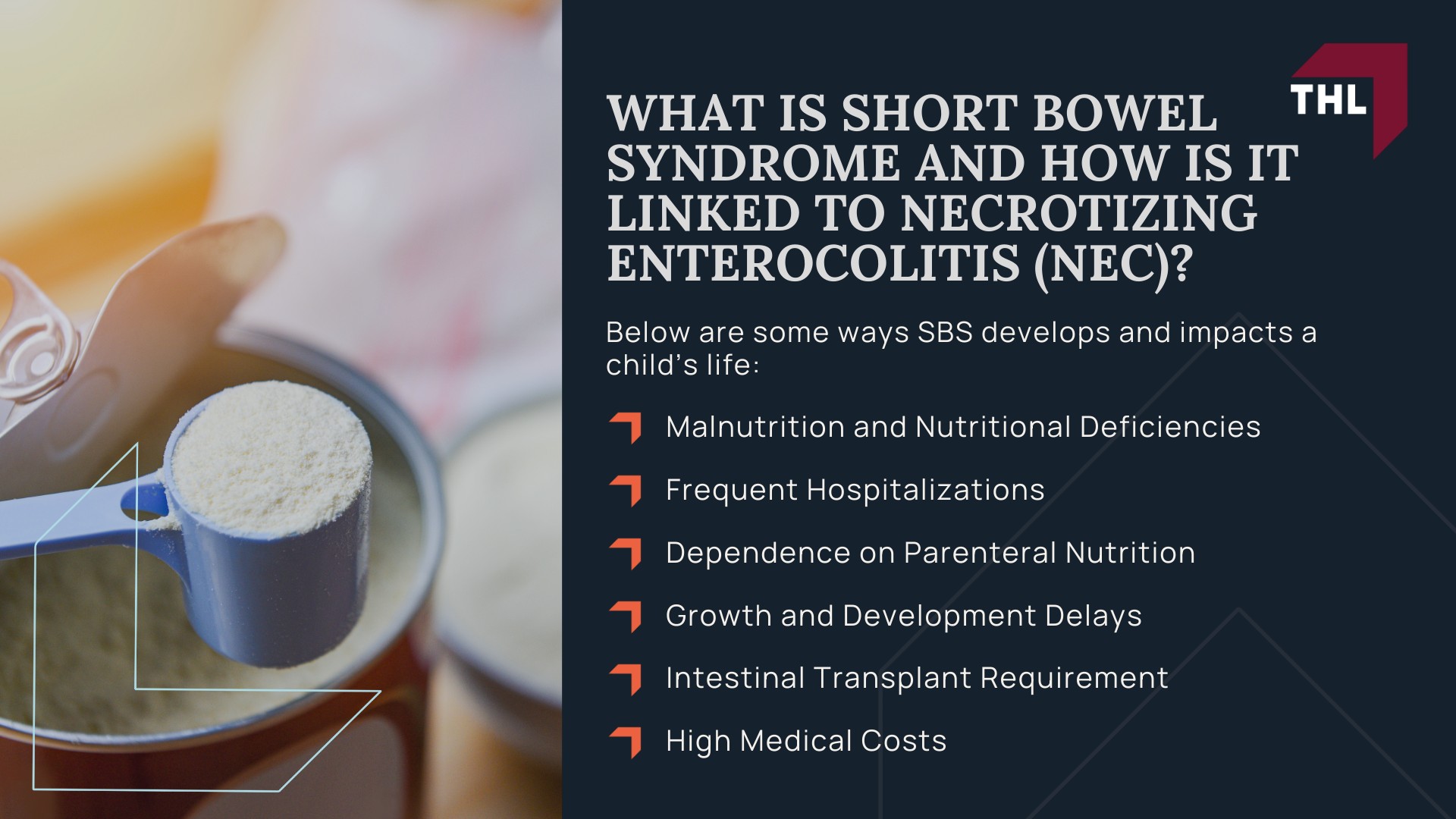 What is Short Bowel Syndrome and How is it Linked to Necrotizing Enterocolitis (NEC)?