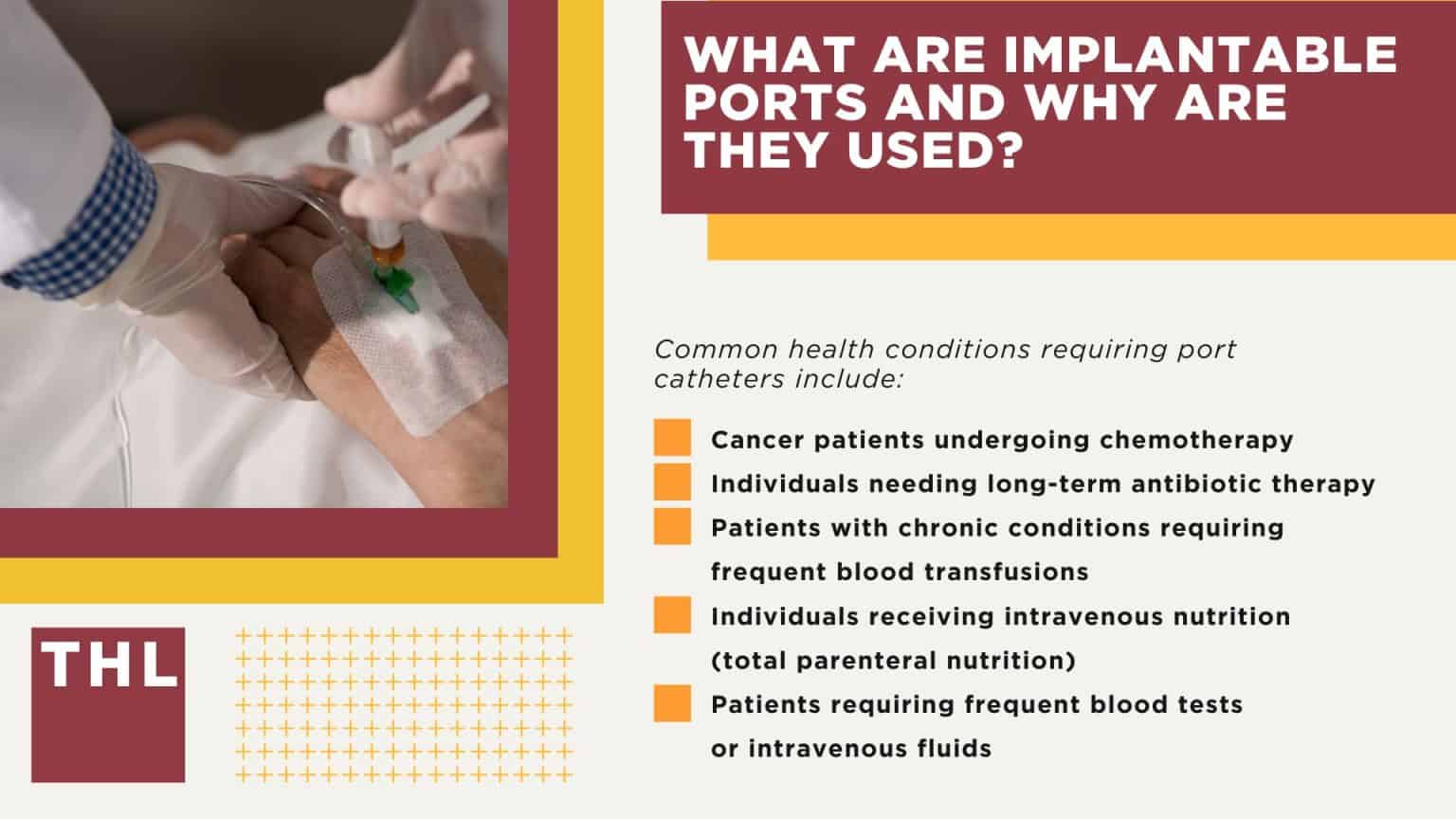 AngioDynamics Port Catheter Lawsuit [October 2025 Update]