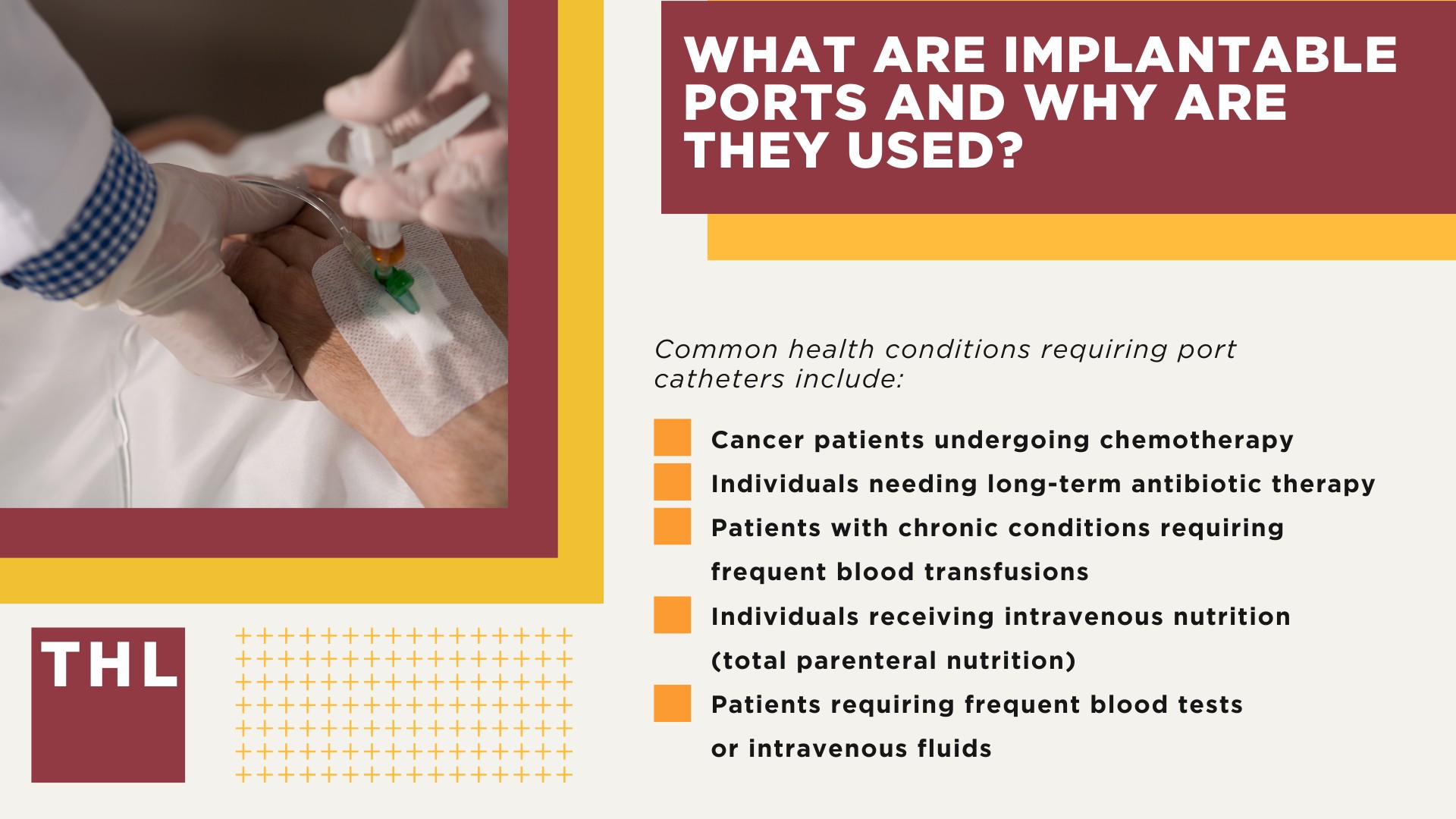 An Overview of the AngioDynamics Port Catheter Lawsuit; What AngioDynamics Inc Devices May Be Defective and Dangerous; Health Risks and Complications Linked to AngioDynamics Port Catheter Devices; What are Implantable Ports and Why are They Used