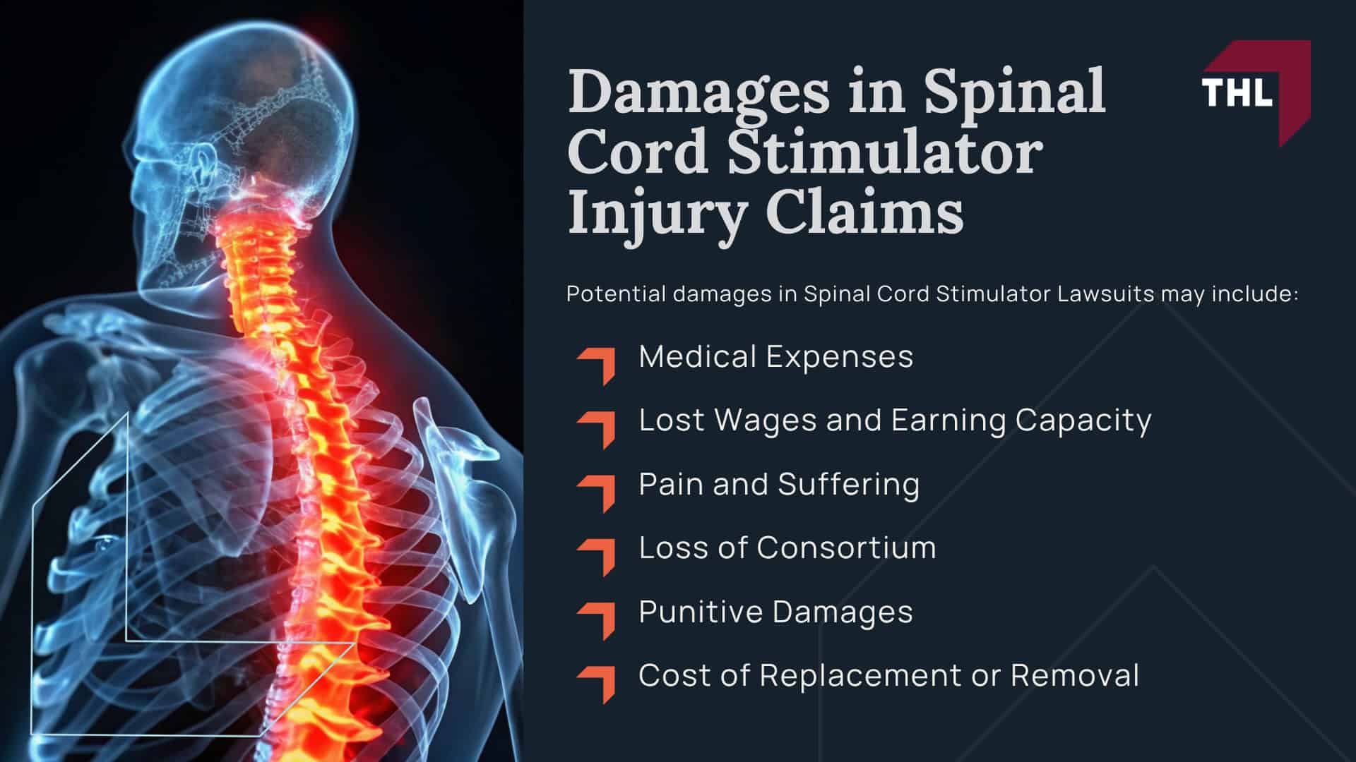 Spinal Cord Stimulator Lawsuit Overview; What Do Spinal Cord Stimulator Lawsuits Allege; What is the Average Spinal Stimulator Lawsuit Settlement Amount; Spinal Cord Stimulator Injury Risks; What is Spinal Cord Stimulation; How are Spinal Cord Stimulators Implanted;  Types of Spinal Cord Stimulator Devices and Manufacturers; Limitations and Risks of Spinal Cord Stimulators; Spinal Cord Stimulator Regulation History; Do You Qualify for a Spinal Cord Stimulator Lawsuit; Gathering Evidence for Spinal Cord Stimulator Litigation; Damages in Spinal Cord Stimulator Injury Claims