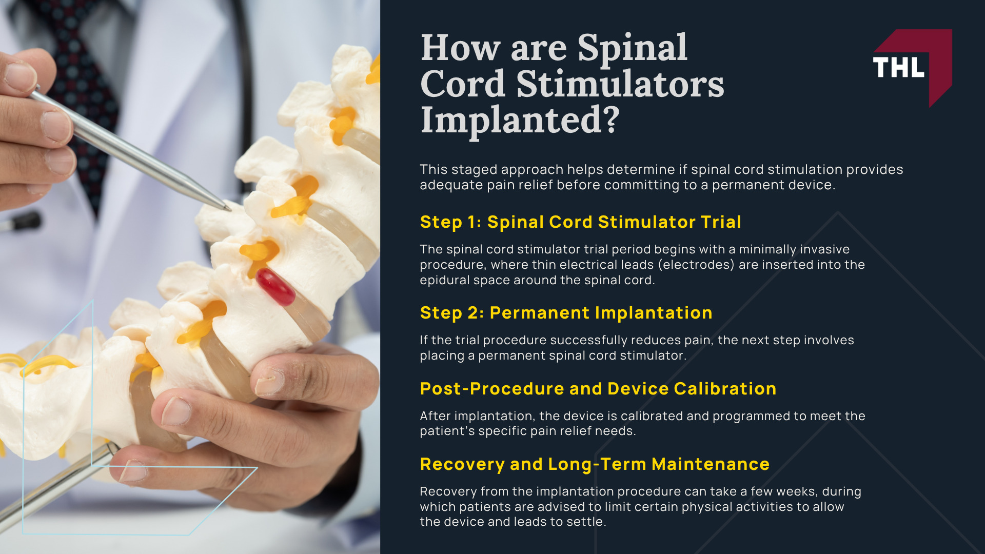 Spinal Cord Stimulator Lawsuit Overview; What Do Spinal Cord Stimulator Lawsuits Allege; Spinal Cord Stimulator Risks_ Injuries and Complications; What is Spinal Cord Stimulation; How are Spinal Cord Stimulators Implanted