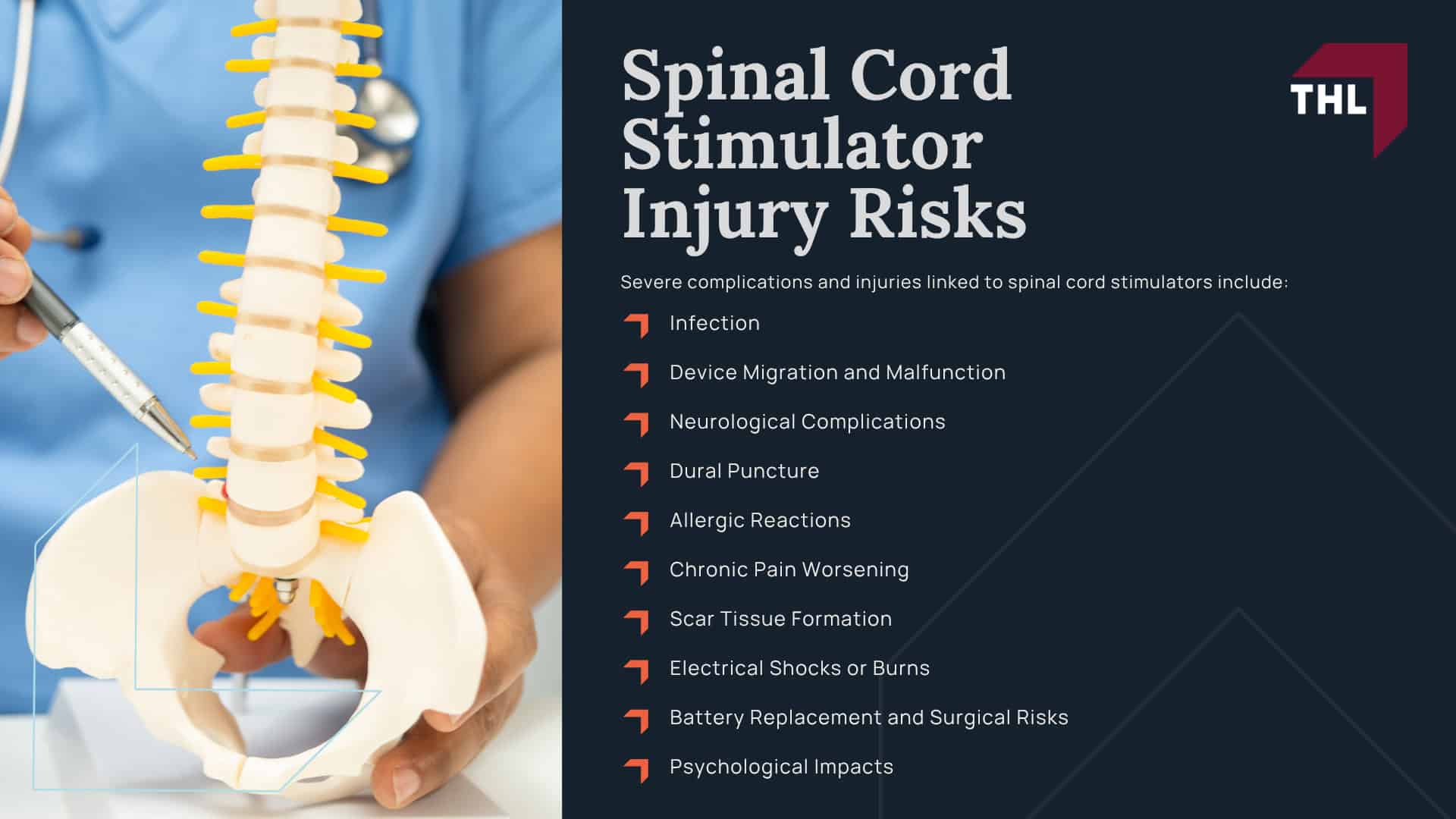 Spinal Cord Stimulator Lawsuit Overview; What Do Spinal Cord Stimulator Lawsuits Allege; What is the Average Spinal Stimulator Lawsuit Settlement Amount; Spinal Cord Stimulator Injury Risks