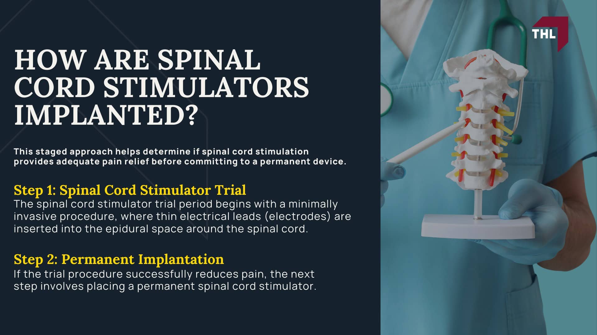 Spinal Cord Stimulator Lawsuit - Spinal Cord Stimulator Lawsuit Overview - torhoerman law; Spinal Cord Stimulator Lawsuit - Spinal Cord Stimulator Injury Risks - torhoerman law; Spinal Cord Stimulator Lawsuit - What is Spinal Cord Stimulation - torhoerman law; Spinal Cord Stimulator Lawsuit - Purpose of Spinal Cord Stimulators Explained - torhoerman law; Spinal Cord Stimulator Lawsuit - How are Spinal Cord Stimulators Implanted_ - torhoerman law