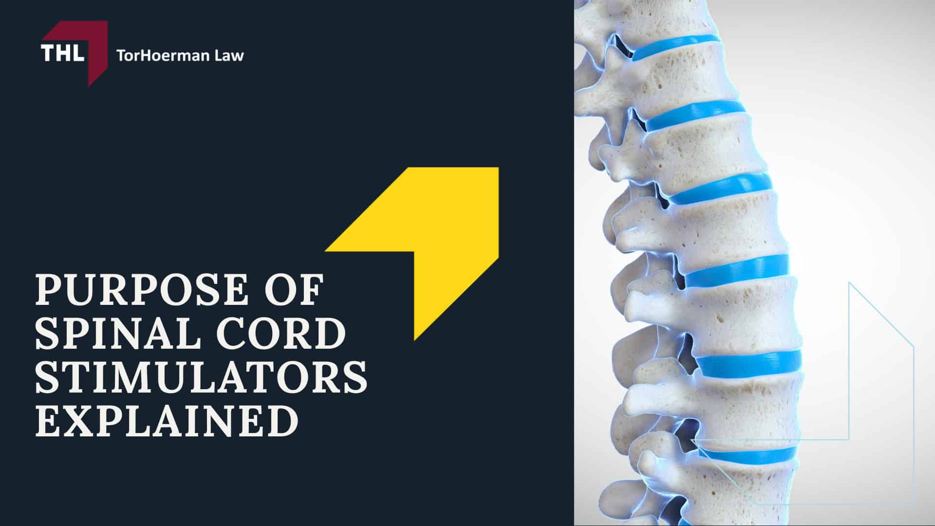 Spinal Cord Stimulator Lawsuit - Spinal Cord Stimulator Lawsuit Overview - torhoerman law; Spinal Cord Stimulator Lawsuit - Spinal Cord Stimulator Injury Risks - torhoerman law; Spinal Cord Stimulator Lawsuit - What is Spinal Cord Stimulation - torhoerman law; Spinal Cord Stimulator Lawsuit - Purpose of Spinal Cord Stimulators Explained - torhoerman law
