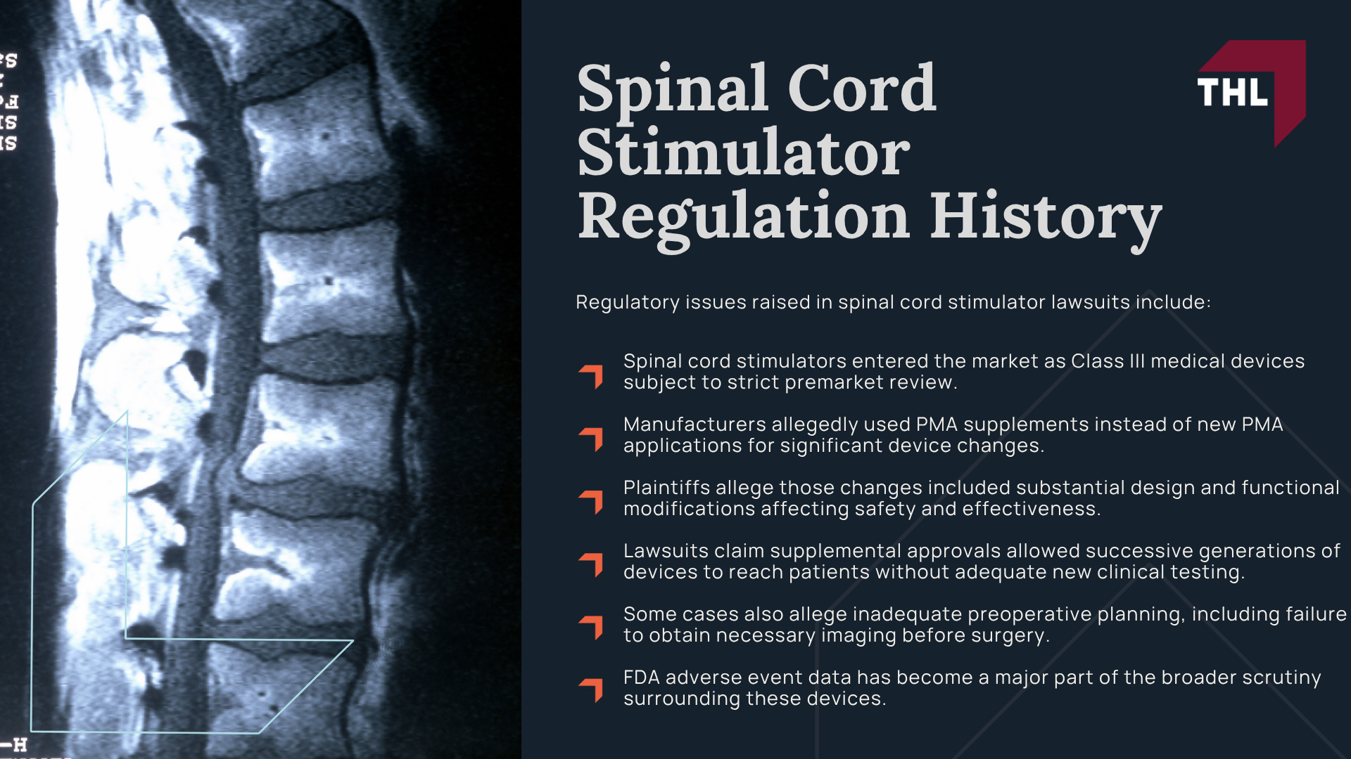 Spinal Cord Stimulator Lawsuit Overview; What Do Spinal Cord Stimulator Lawsuits Allege; Spinal Cord Stimulator Risks_ Injuries and Complications; What is Spinal Cord Stimulation; How are Spinal Cord Stimulators Implanted; Types of Spinal Cord Stimulator Devices and Manufacturers; Spinal Cord Stimulator Regulation History