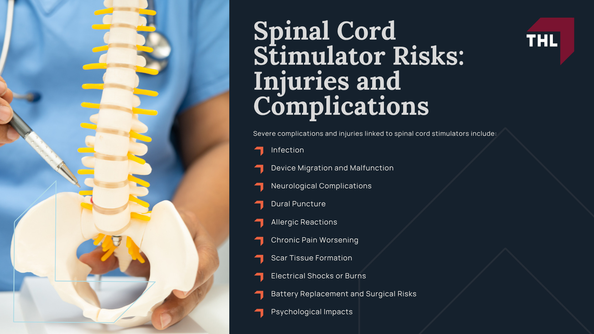 Spinal Cord Stimulator Lawsuit Overview; What Do Spinal Cord Stimulator Lawsuits Allege; Spinal Cord Stimulator Risks_ Injuries and Complications