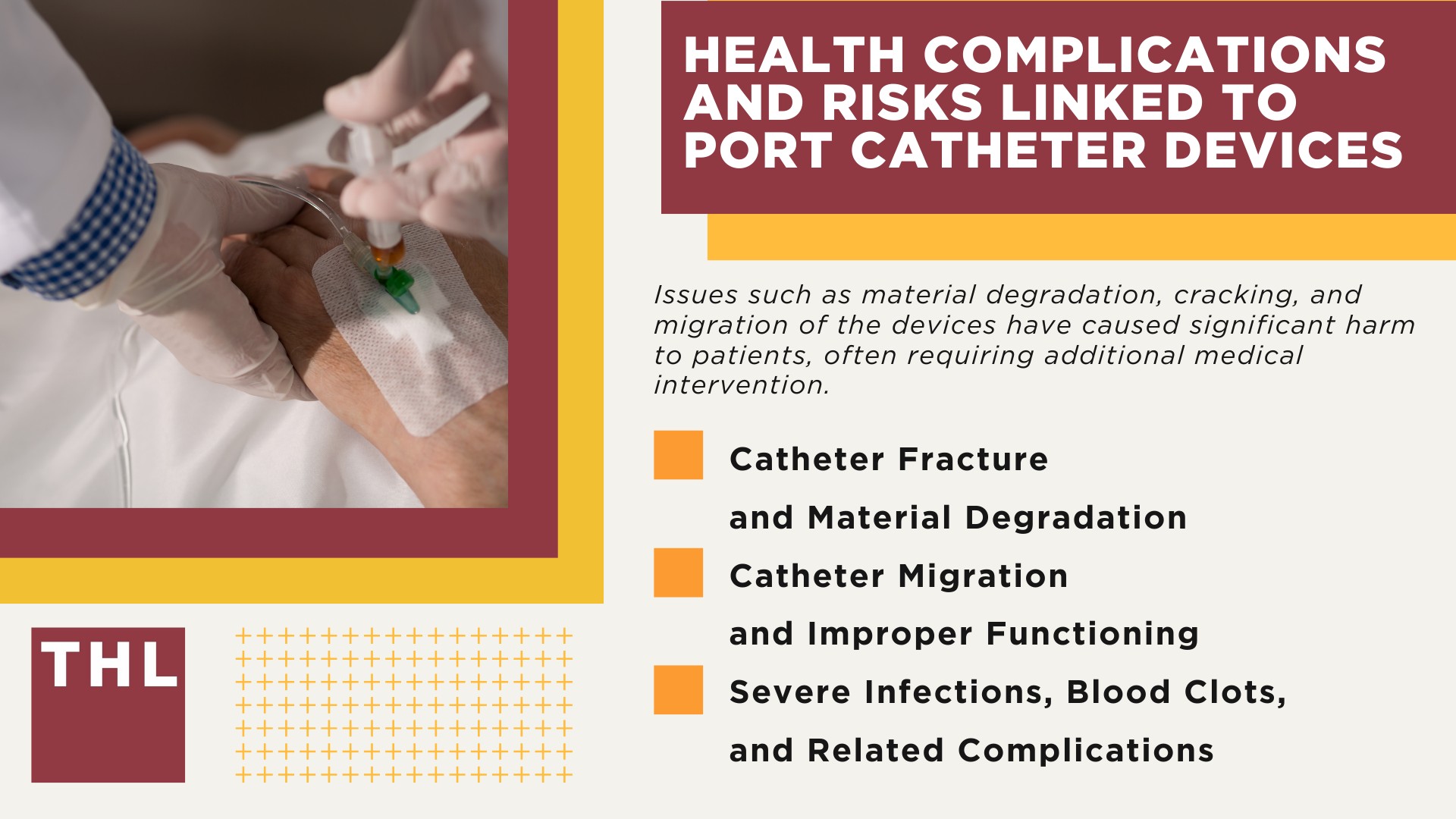 An Overview of Health Risks Posed by Port Catheter Devices; How Do Implantable Port Devices Work and Why Are They Used; Health Complications and Risks Linked to Port Catheter Devices