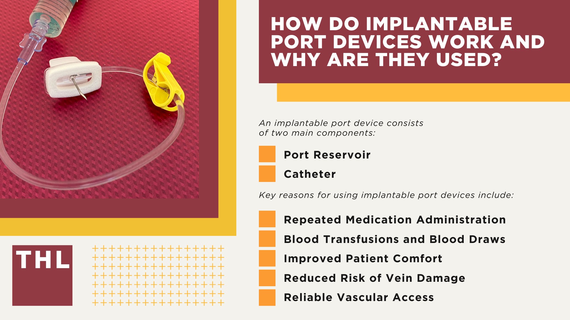 An Overview of Health Risks Posed by Port Catheter Devices; How Do Implantable Port Devices Work and Why Are They Used