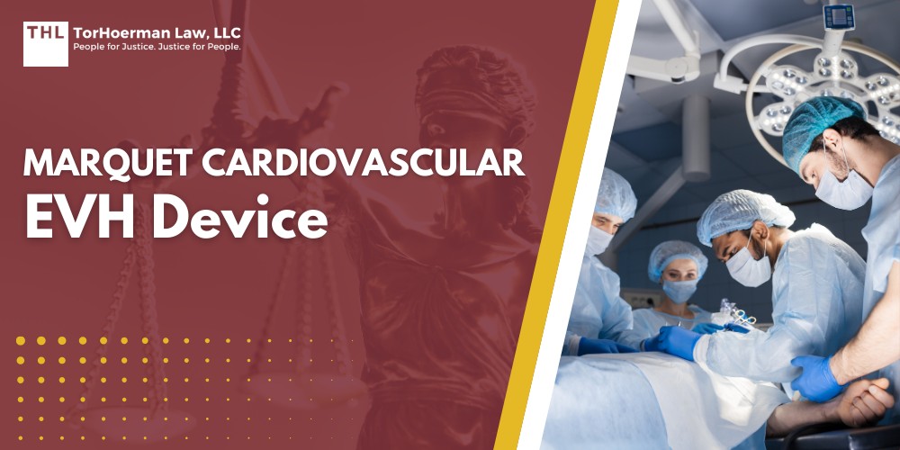 Marquet Cardiovascular EVH Device; Marquet Cardiovascular EVH Device Recall Information; Potential Injuries Caused by Defective EVH Devices; What is the Marquet Cardiovascular EVH Device and Why is it Used; TorHoerman Law_ Investigating Injuries Linked to Marquet Cardiovascular EVH Devices