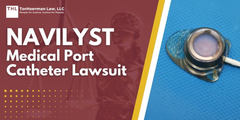 Navilyst Medical Port Catheter Lawsuit; An Overview of Health Risks Posed by Port Catheter Devices; How Do Implantable Port Devices Work and Why Are They Used; Health Complications and Risks Linked to Port Catheter Devices; Do You Qualify for a Navilyst Medical_AngioDynamics Port Lawsuit; Gathering Evidence for Port-a-Cath Lawsuits; Damages in Navilyst Medical_AngioDynamics Port Catheter Lawsuits; TorHoerman Law_ Your Port Catheter Injury Lawyer