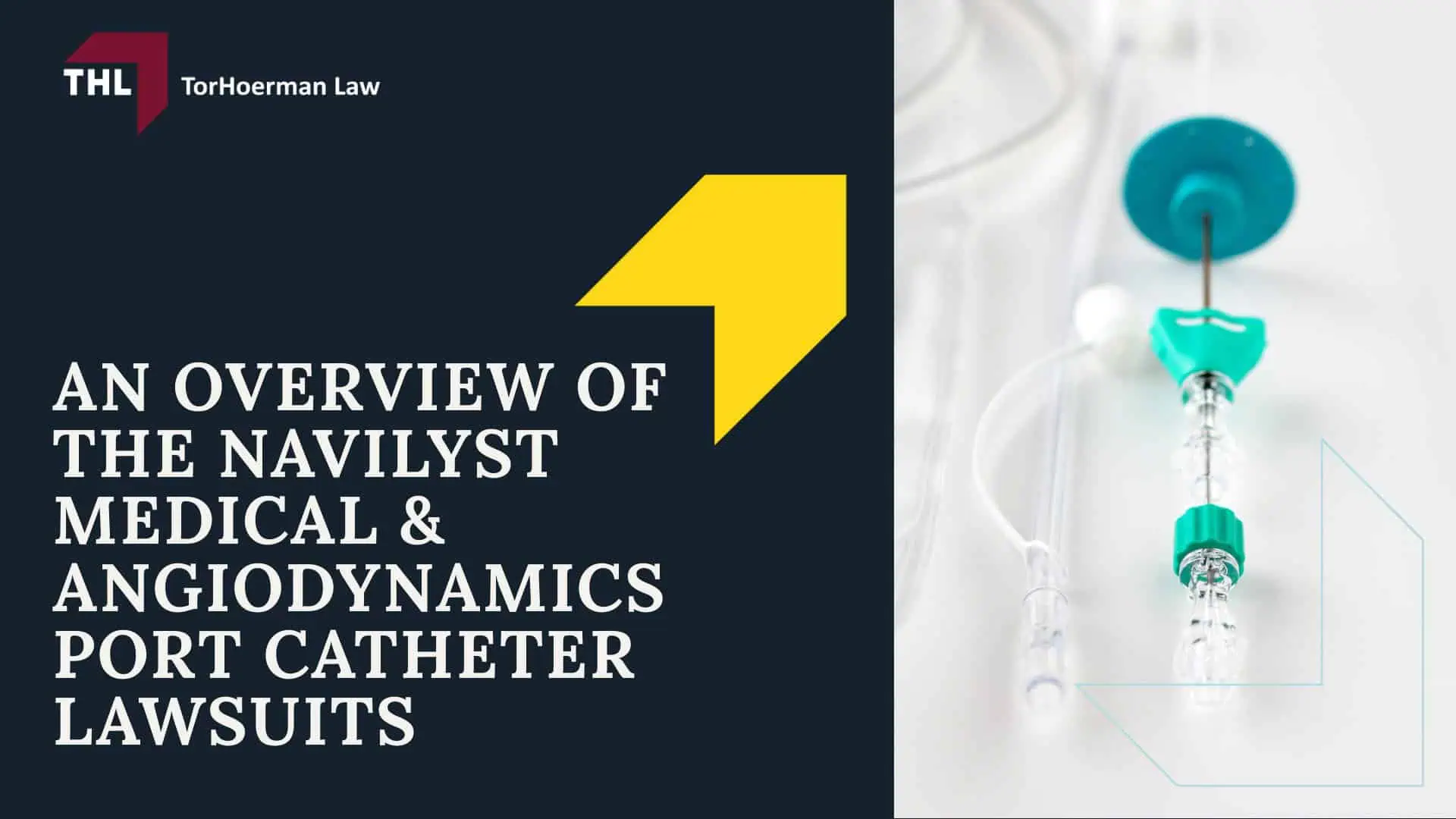 Navilyst Medical Port Catheter Lawsuit - An Overview of the Navilyst Medical & AngioDynamics Port Catheter Lawsuits - torhoerman law