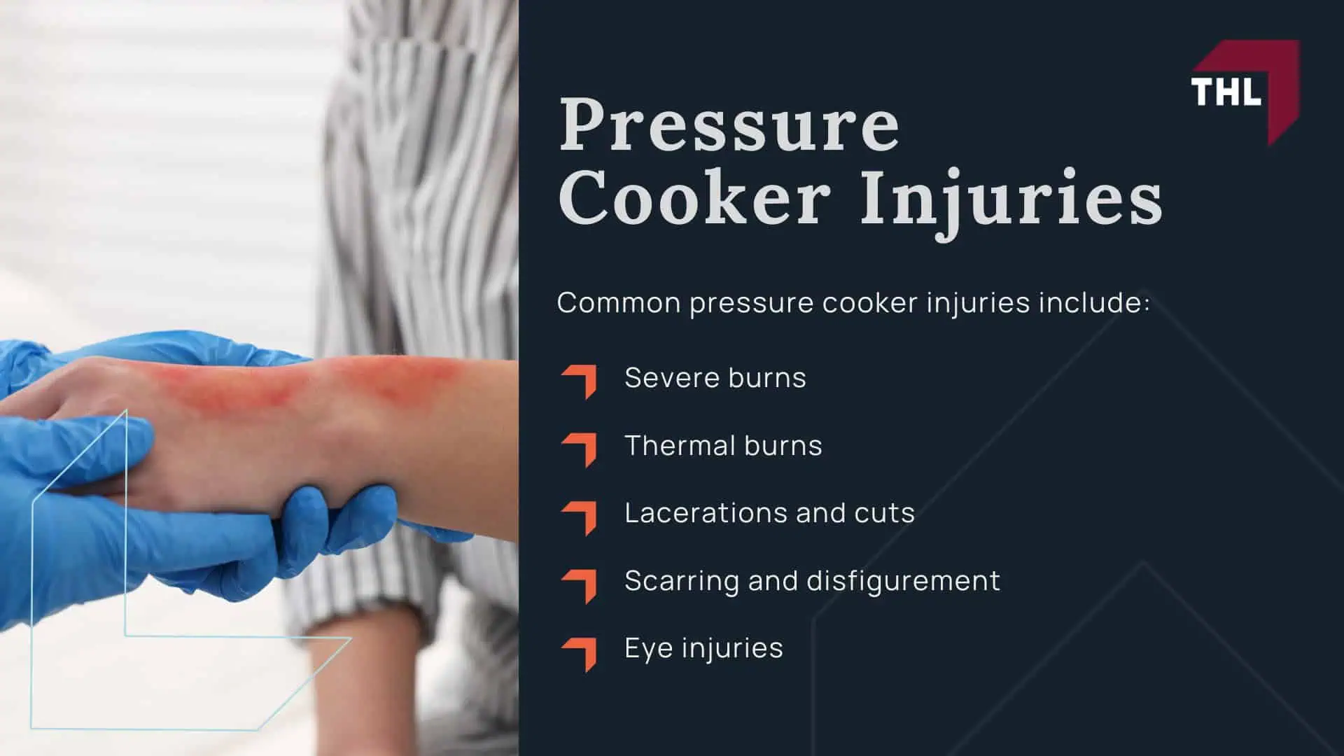 NuWave Pressure Cooker Lawsuit - How and Why Do Pressure Cookers Explode_ - torhoerman law; NuWave Pressure Cooker Lawsuit - Pressure Cooker Injuries - torhoerman law