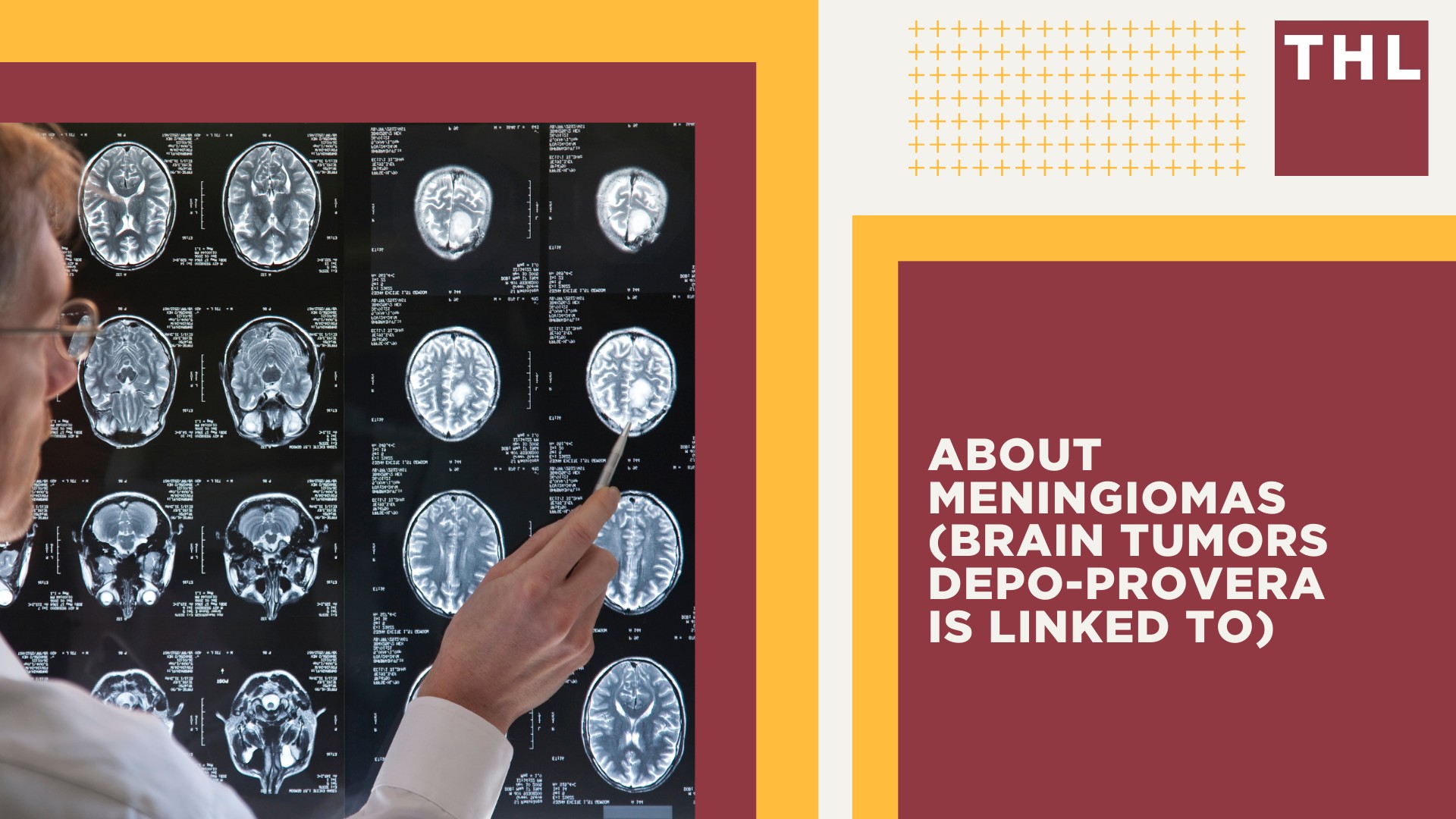 Active Lawsuit_ Depo-Provera Users Claim Pfizer Failed to Warn of Brain Tumor Risk; The Basis for the Depo Provera Lawsuit Explained; Scientific Evidence Links Depo-Provera to an Increased Risk of Brain Tumors; About Meningiomas (Brain Tumors Depo-Provera is Linked To)