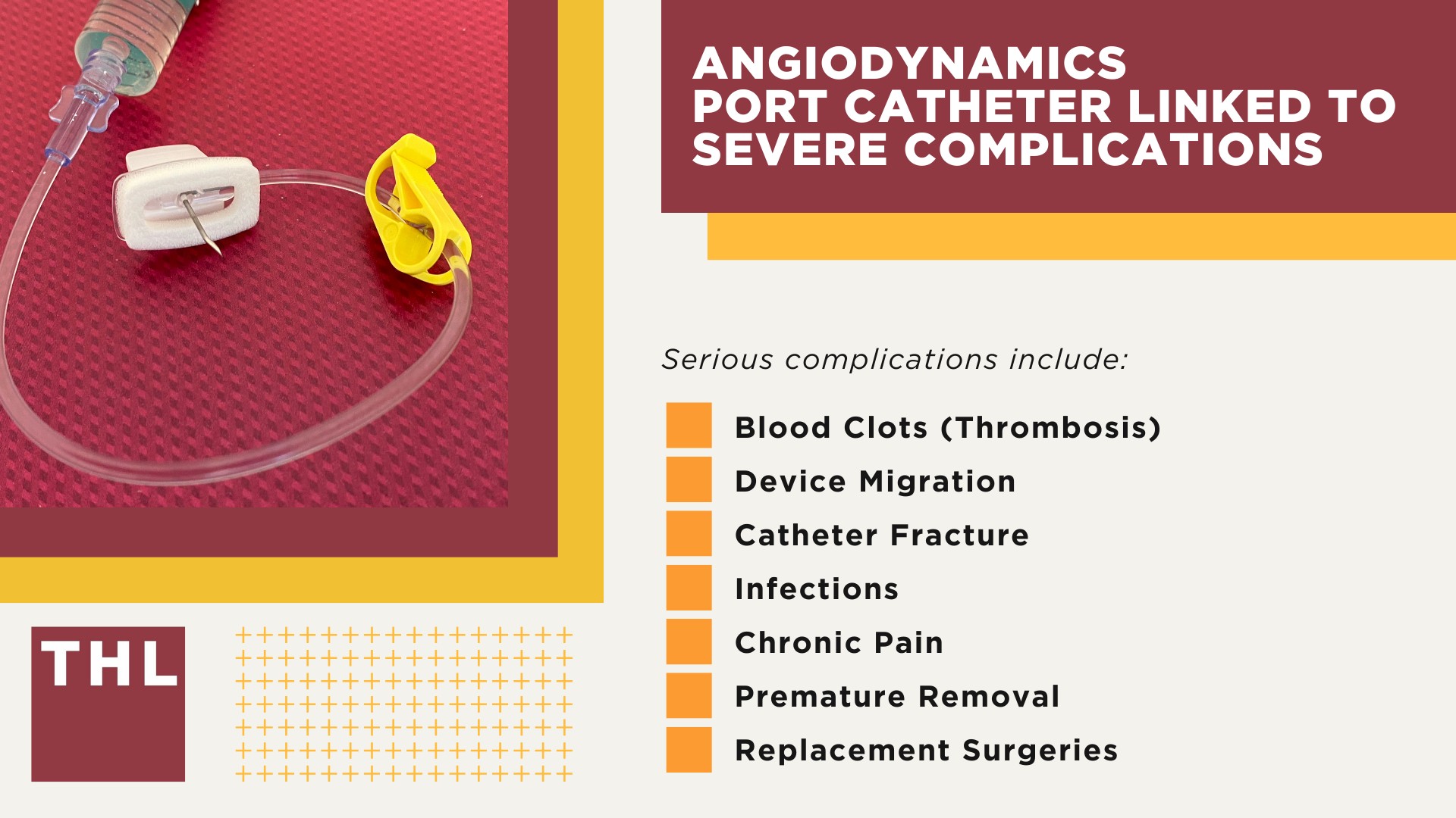 Projected AngioDynamics Port Catheter Lawsuit Settlement Amounts; AngioDynamics Port Catheter Linked to Severe Complications