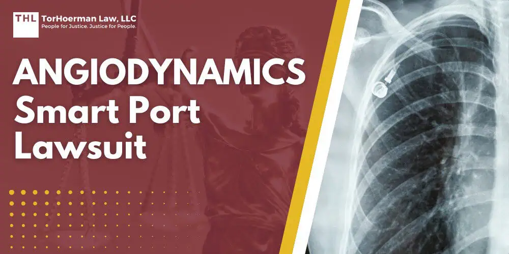 AngioDynamics Smart Port Lawsuit; What is the AngioDynamics Smart Port Lawsuit; Health Complications, Device Issues & Significant Risks Linked to AngioDynamics Port Catheters; Do You Qualify for the AngioDynamics Port Catheter Lawsuit; Gathering Evidence for an AngioDynamics Port Lawsuit; Damages in AngioDynamics Port Catheter Lawsuits; TorHoerman Law_ AngioDynamics Port Lawyers