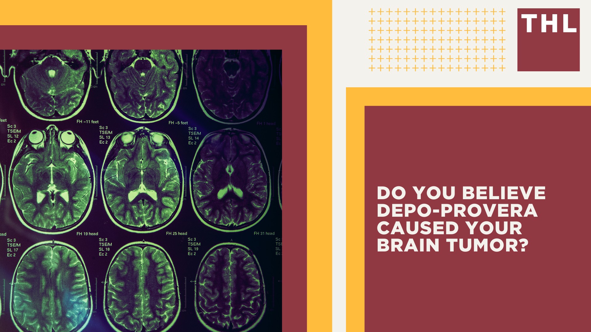 Active Lawsuit_ Depo-Provera Users Claim Pfizer Failed to Warn of Brain Tumor Risk; The Basis for the Depo Provera Lawsuit Explained; Scientific Evidence Links Depo-Provera to an Increased Risk of Brain Tumors; About Meningiomas (Brain Tumors Depo-Provera is Linked To); Complications and Health Effects of Meningioma; Do You Believe Depo-Provera Caused Your Brain Tumor