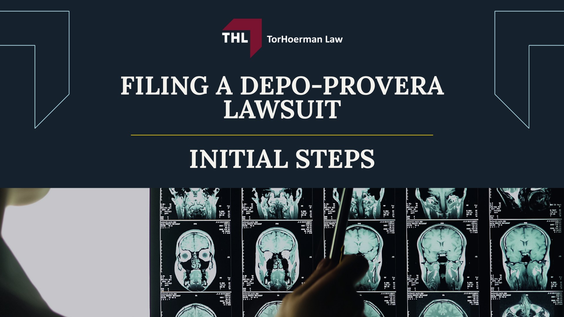What You Need to Know Before Filing a Depo-Provera Lawsuit; The Basis of the Depo-Provera Brain Tumor Lawsuit; Scientific Evidence Links Depo-Provera to an Increased Risk of Developing Brain Tumors; The Role of a Depo-Provera Lawyer Explained; The Process for Legal Claims in the Depo-Provera Lawsuit;  IS THERE A DEPO-PROVERA CLASS ACTION LAWSUIT -; Filing a Depo-Provera Lawsuit: Initial Steps