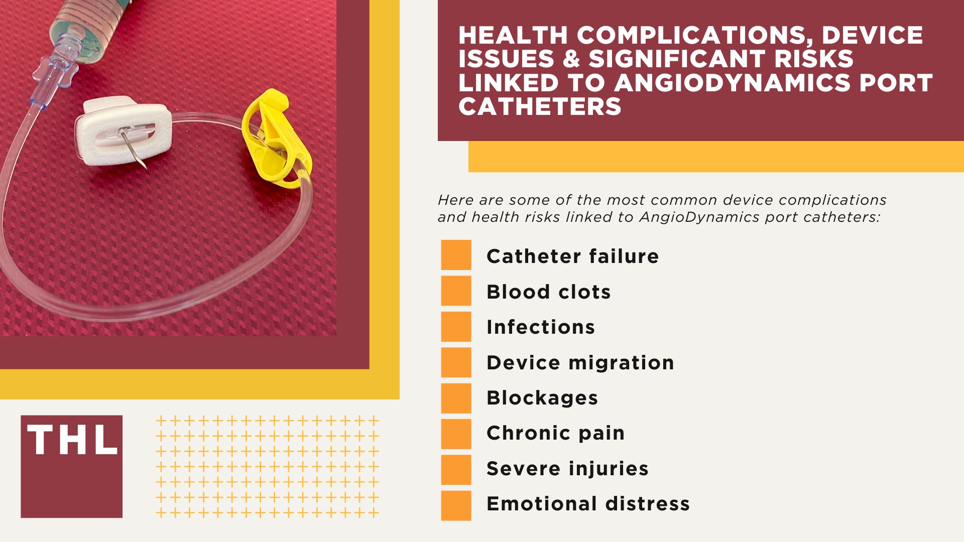 What is the AngioDynamics Smart Port Lawsuit; Health Complications, Device Issues & Significant Risks Linked to AngioDynamics Port Catheters