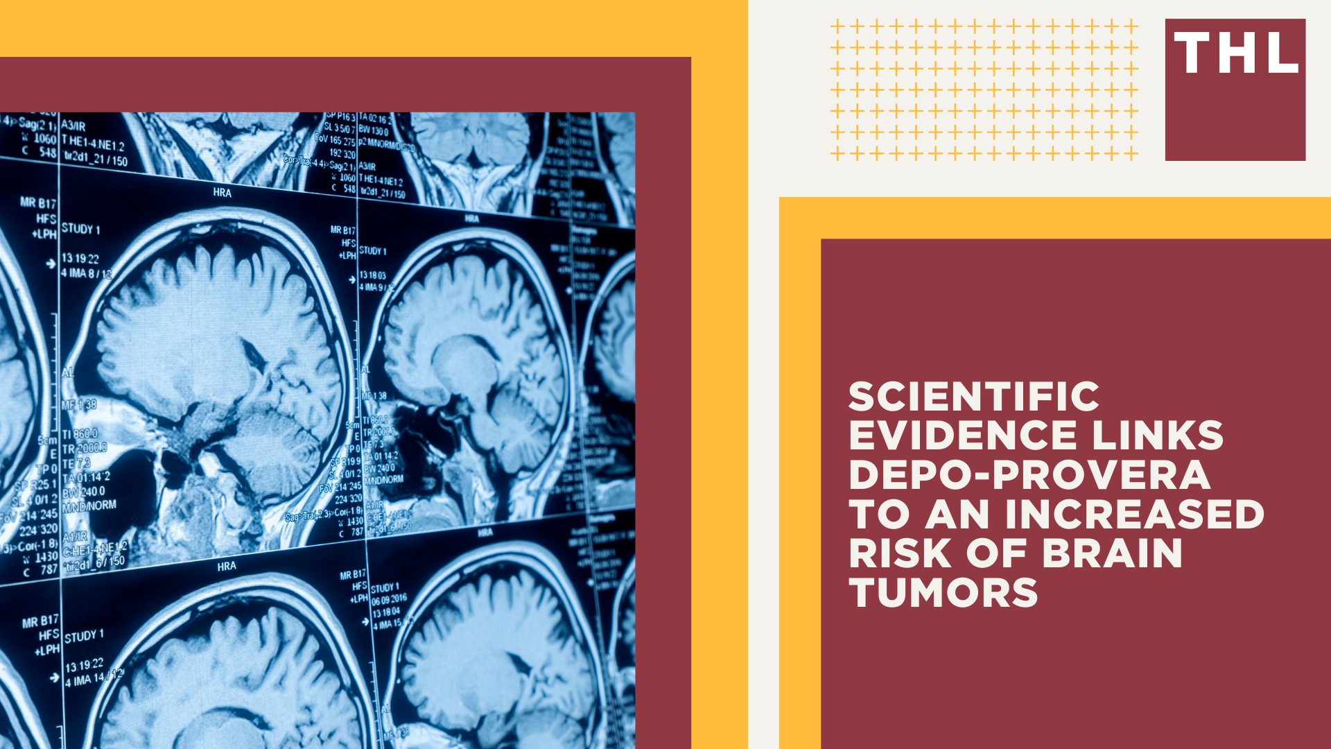 Active Lawsuit_ Depo-Provera Users Claim Pfizer Failed to Warn of Brain Tumor Risk; The Basis for the Depo Provera Lawsuit Explained; Scientific Evidence Links Depo-Provera to an Increased Risk of Brain Tumors