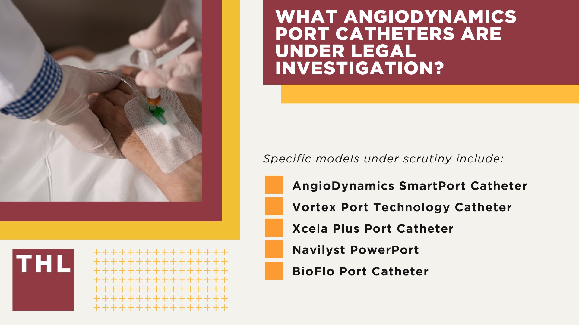 Projected AngioDynamics Port Catheter Lawsuit Settlement Amounts; AngioDynamics Port Catheter Linked to Severe Complications; What AngioDynamics Port Catheters are Under Legal Investigation