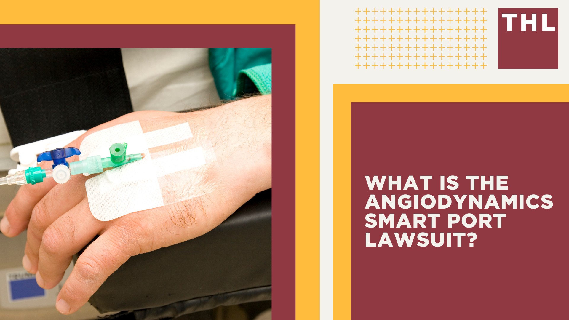 What is the AngioDynamics Smart Port Lawsuit