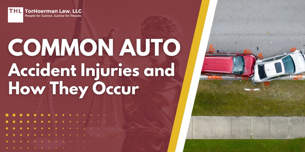 Guides 2 Common Auto Accident Injuries and How They Occur; Common Car Accident Injuries; Delayed Injury Symptoms_ Why You Might Feel Fine at First; Why You Should Seek Medical Treatment Immediately After Your Car Accident; How a Car Accident Lawyer Can Help You; Key Takeaway_ Protect Your Health and Your Rights