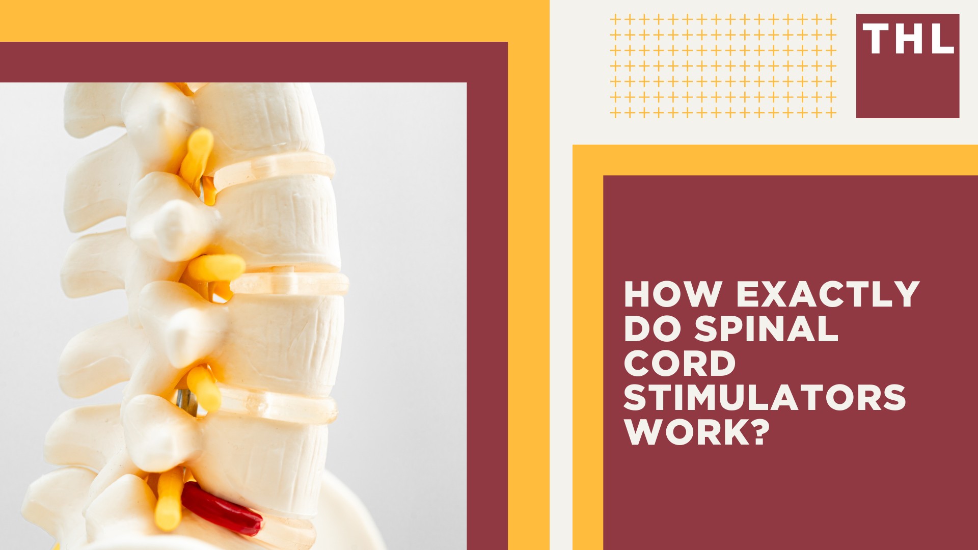 Suffer Injuries After Spinal Cord Stimulator Implantation_ You May Be Eligible for Legal Action; Types of Spinal Cord Stimulator Injuries and Their Causes; How Exactly Do Spinal Cord Stimulators Work