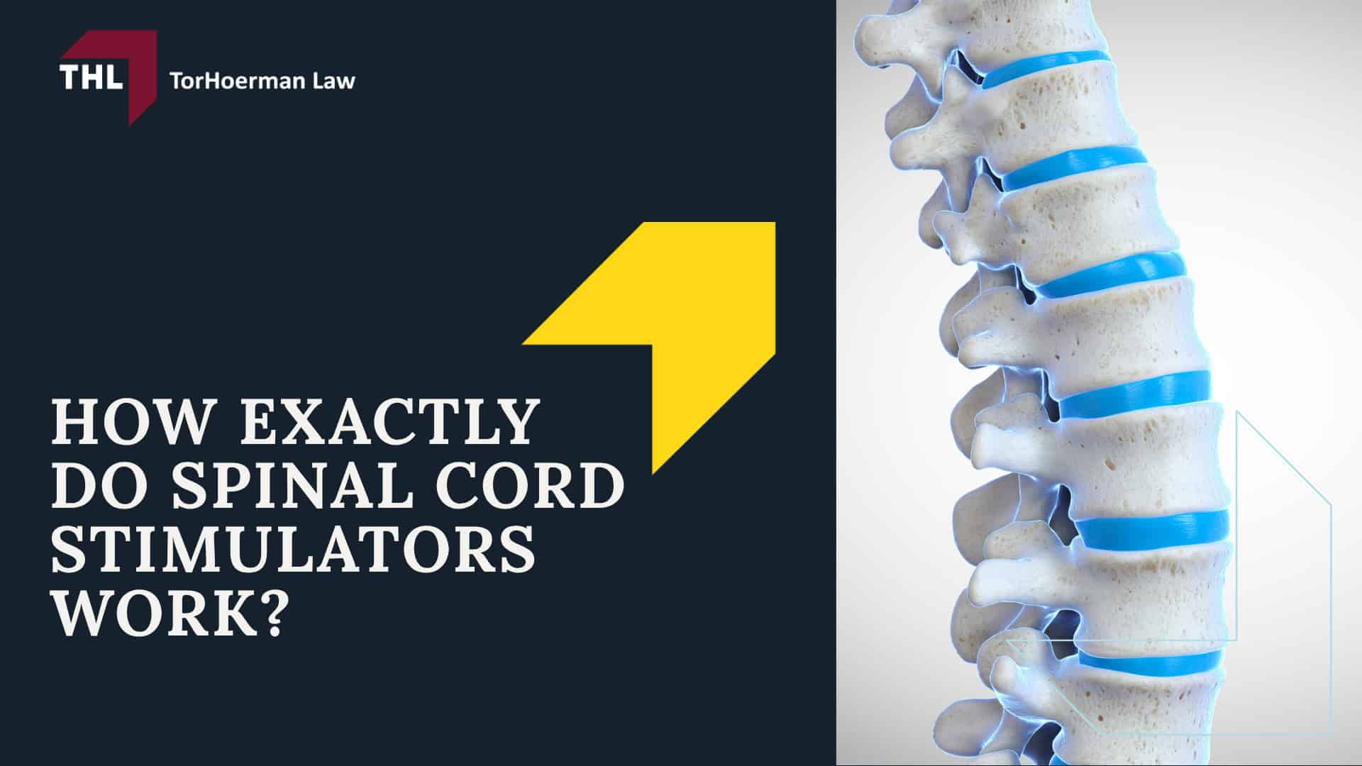 Suffer Injuries After Spinal Cord Stimulator Implantation_ You May Be Eligible for Legal Action; Types of Spinal Cord Stimulator Injuries and Their Causes; How Exactly Do Spinal Cord Stimulators Work