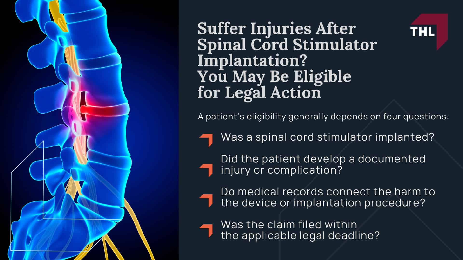 Suffer Injuries After Spinal Cord Stimulator Implantation_ You May Be Eligible for Legal Action
