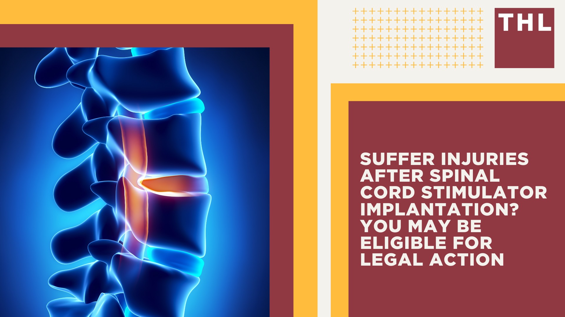 Suffer Injuries After Spinal Cord Stimulator Implantation_ You May Be Eligible for Legal Action