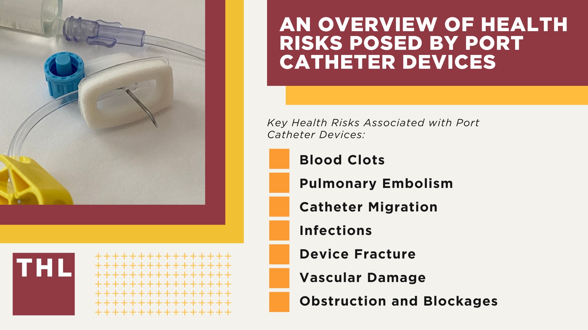Port Catheter Lawsuits Filed Against Medical Device Manufacturers; Bard PowerPort Lawsuit Overview; AngioDynamics Port Catheter Lawsuit Overview; An Overview of Health Risks Posed by Port Catheter Devices