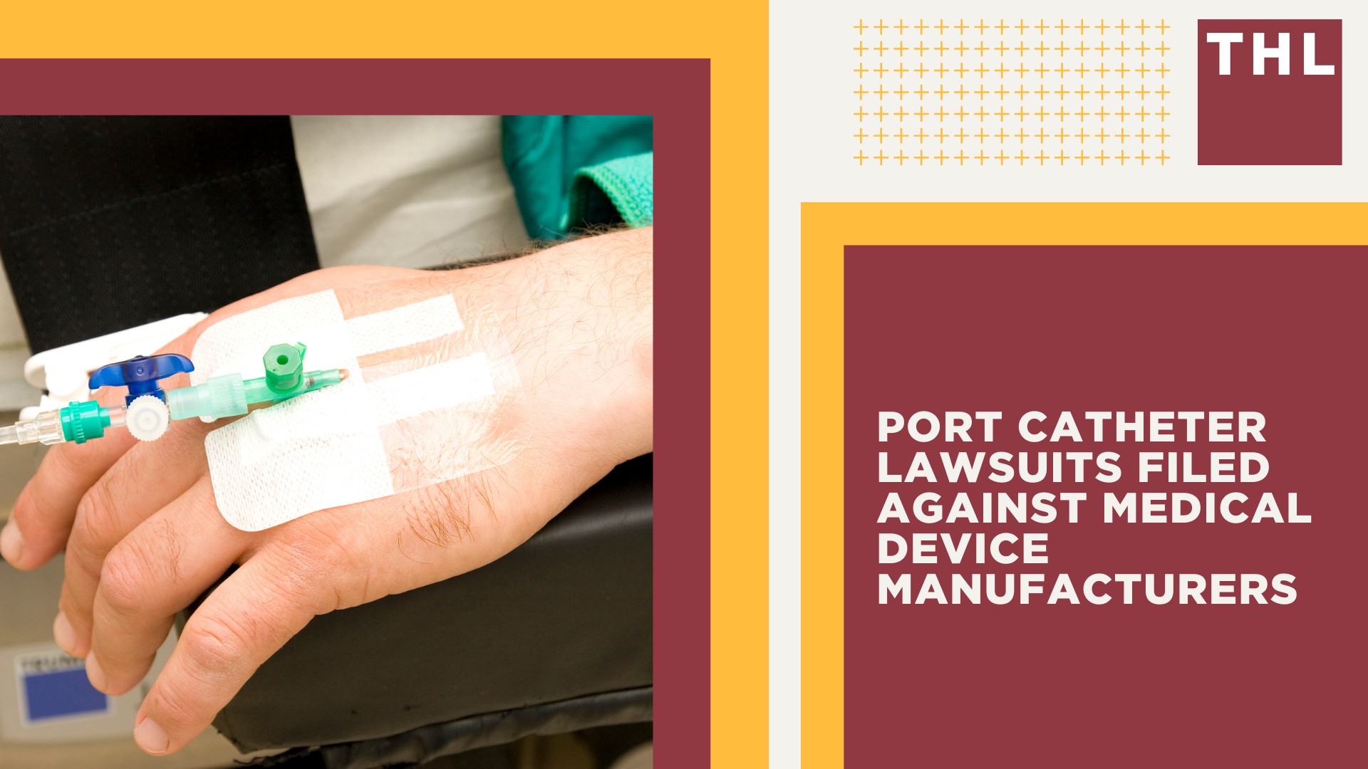 Port Catheter Lawsuits Filed Against Medical Device Manufacturers
