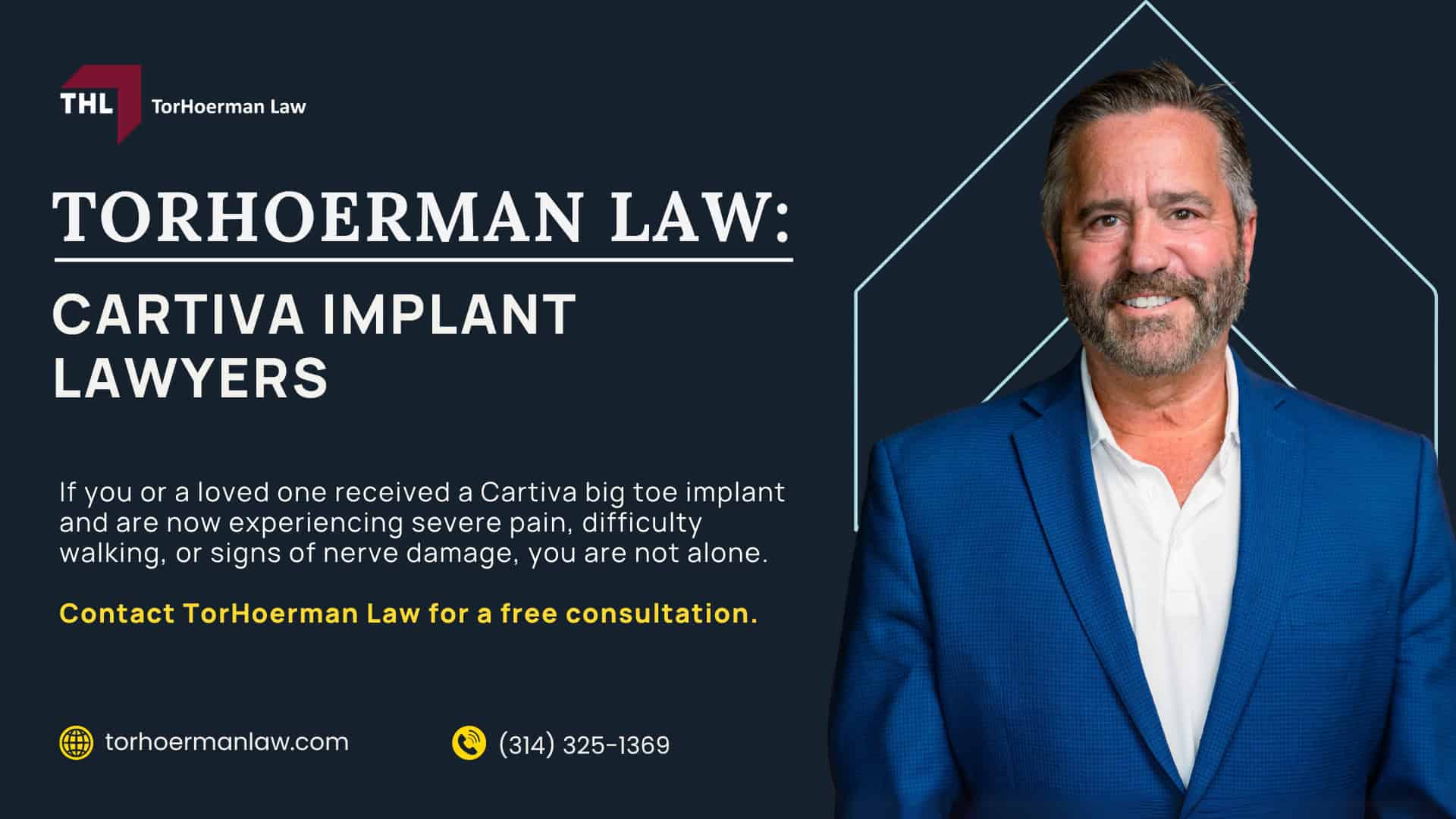 Cartiva Toe Implant Lawsuit Overview; What Devices are Included in the Cartiva Toe Implant Recall; What Companies are Named in the Cartiva Implant Lawsuit; Injuries Linked to Cartiva Implant Device Failures; Cartiva Implant Failure Symptoms; Do You Qualify for the Cartiva Implant Lawsuit; Gathering Evidence for Cartiva Implant Failure Lawsuits; Damages in a Cartiva Lawsuit;  TorHoerman Law_ Cartiva Implant Lawyers