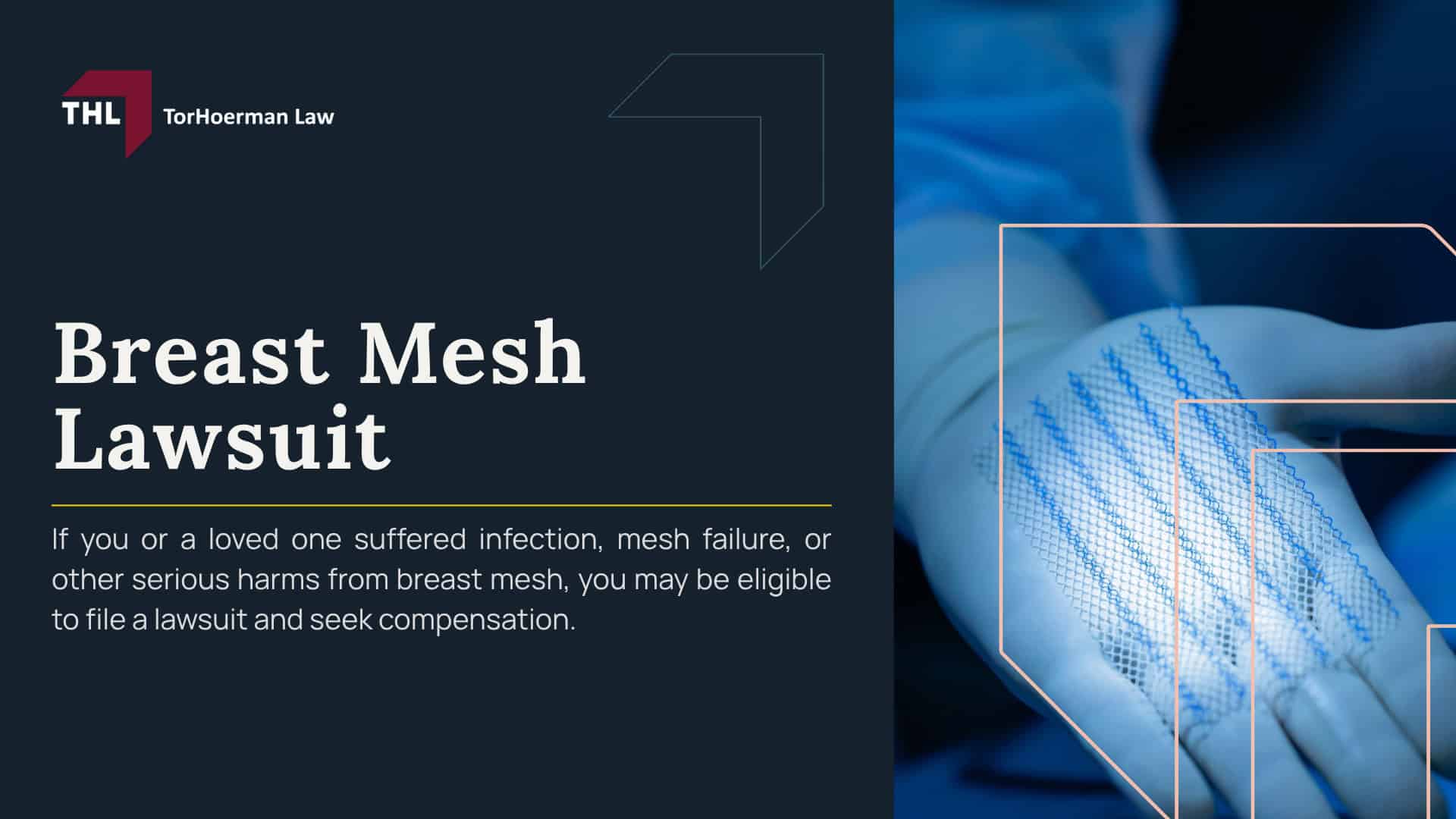 Breast Mesh Lawsuit; Breast Mesh Lawsuit - What Is Breast Mesh_ - torhoerman law; Breast Mesh Lawsuit - How Breast Mesh Works in Cosmetic and Reconstructive Surgery - torhoerman law; Breast Mesh Lawsuit - What Is Breast Mesh_ - torhoerman law; Breast Mesh Lawsuit - How Breast Mesh Works in Cosmetic and Reconstructive Surgery - torhoerman law; FDA Status and Safety Concerns Surrounding Breast Mesh Products; Breast Mesh Lawsuit - Breast Mesh Products Named in Lawsuits and Regulatory Notices; Breast Mesh Lawsuit - Breast Mesh and Internal Bra Complications; Breast Mesh Lawsuit - Do You Qualify for a Breast Mesh Lawsuit; Breast Mesh Lawsuit - Gathering Evidence for a Breast Mesh Lawsuit; Breast Mesh Lawsuit - Potential Compensation and Damages in Breast Mesh Lawsuits; Breast Mesh Lawsuit - Breast Mesh Manufacturers Under Review; Breast Mesh Lawsuit - TorHoerman Law_ Investigating Breast Mesh Complications and Injuries