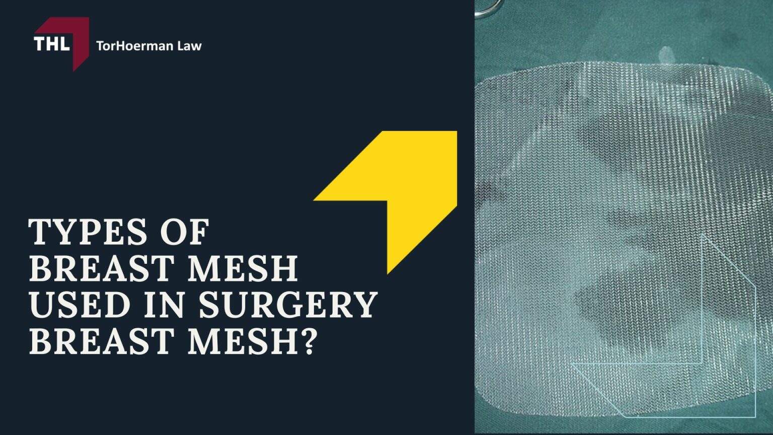 Breast Mesh Lawsuit [2026 Update] | TorHoerman Law